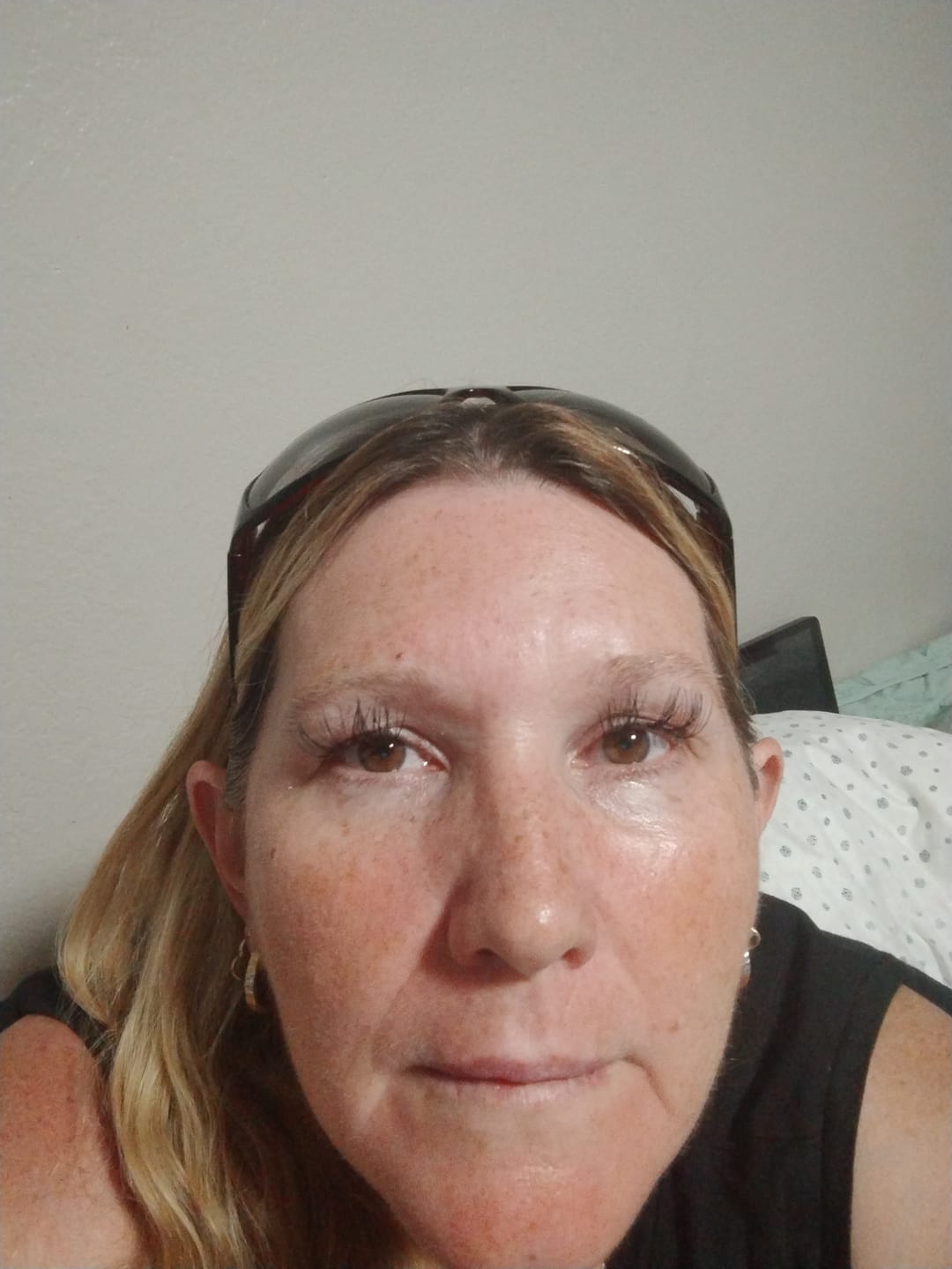 Customer photo review of 1 Month Supply - Micro Infusion Patches