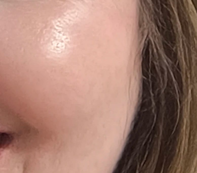 Customer photo review of Dispositivo de Alta Frecuencia Monniva