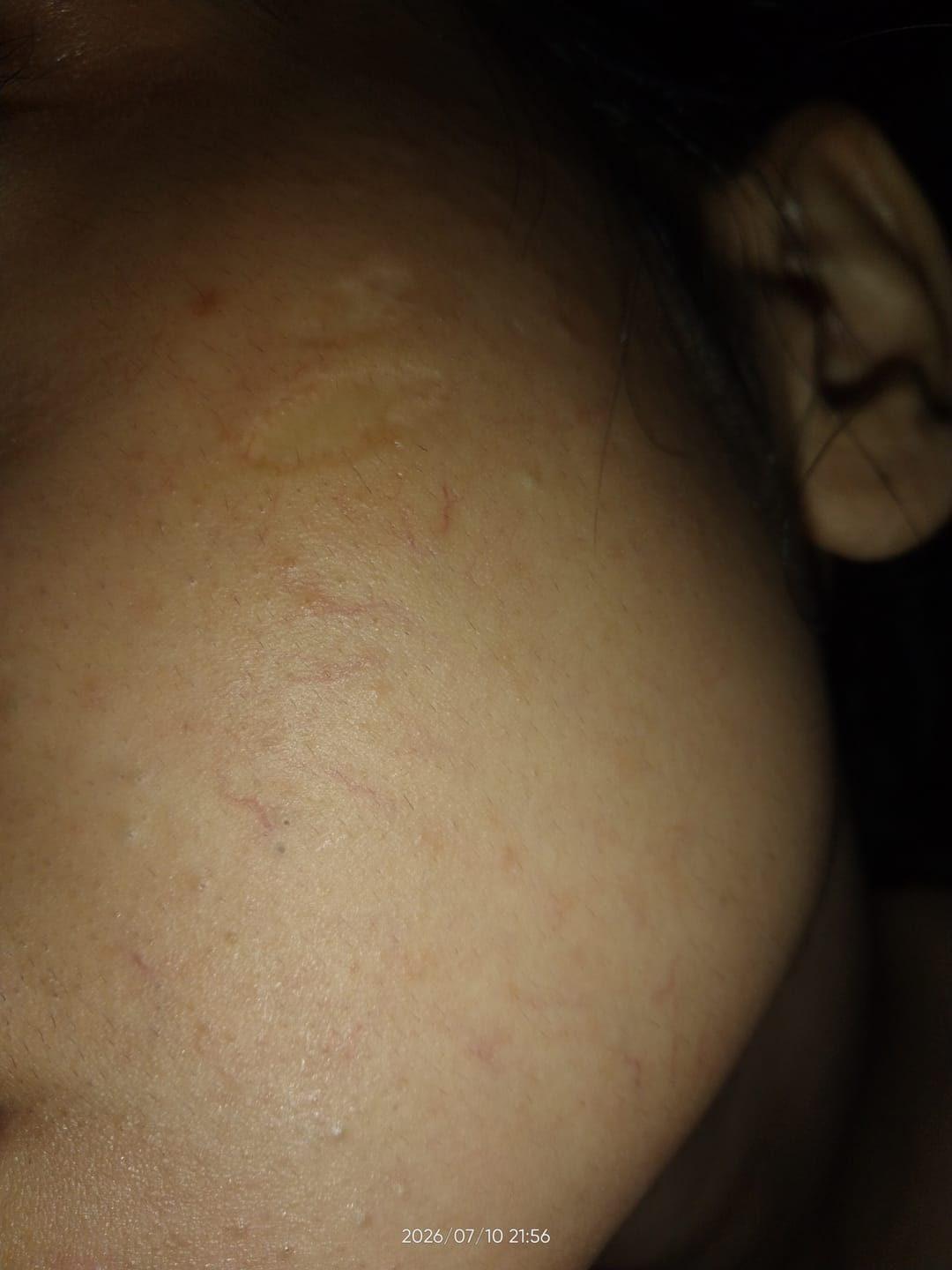 Customer photo review of Glutathione 3% Rich Formula Beauty Cream
