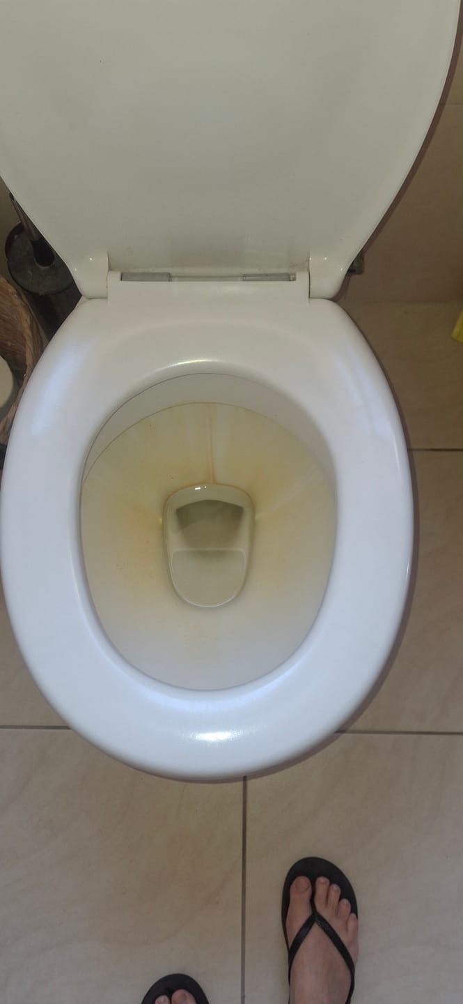 Customer photo review of White Magic Pumice Toilet Bowl Eraser Mega 4 Pack