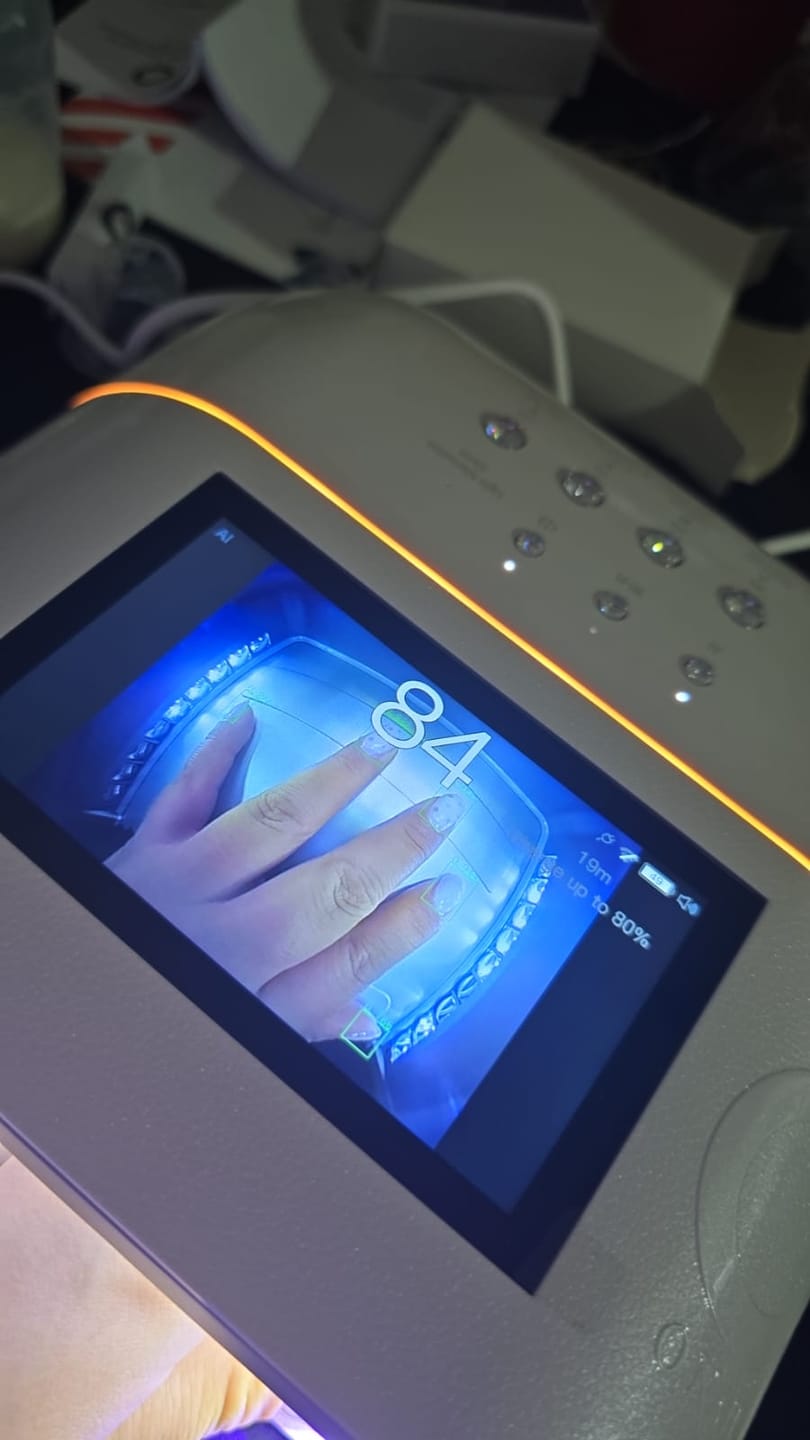 Customer photo review of Remote Control for ONAIL AI Nail Lamp (SUNX PRO & MAX)