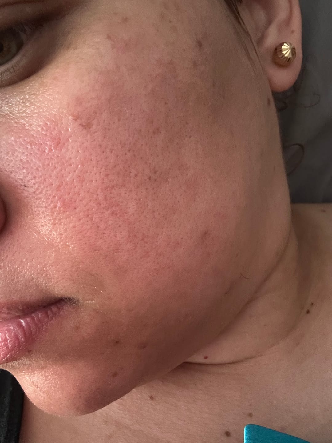 Customer photo review of Tati's mixsoon Complete Night Routine