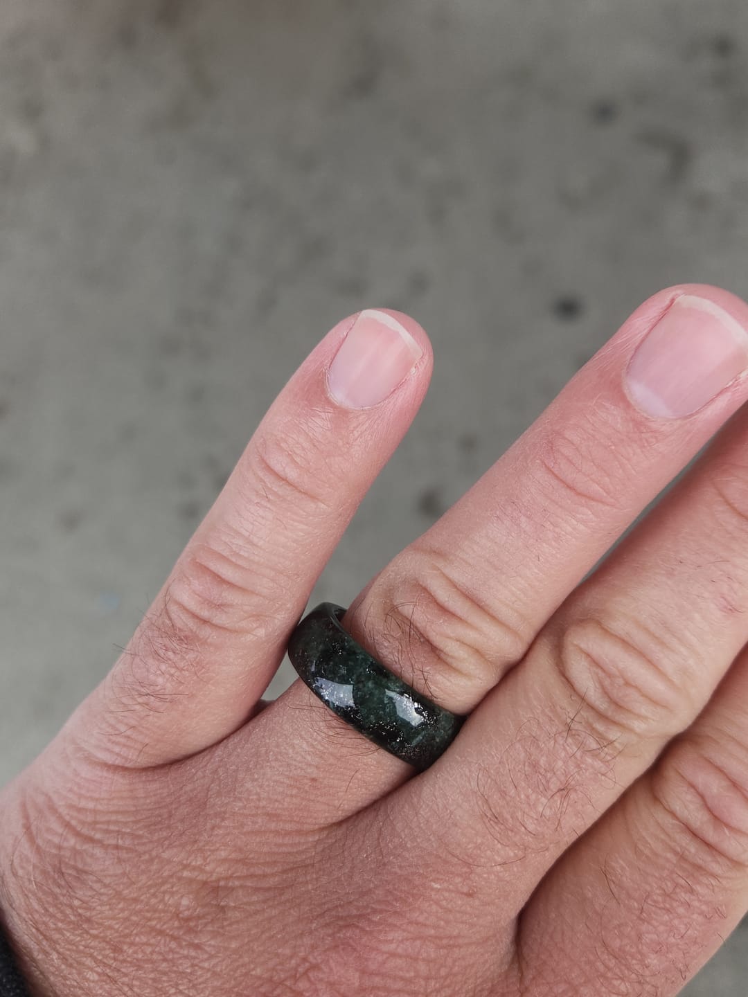 Customer photo review of Shipping costs United States+