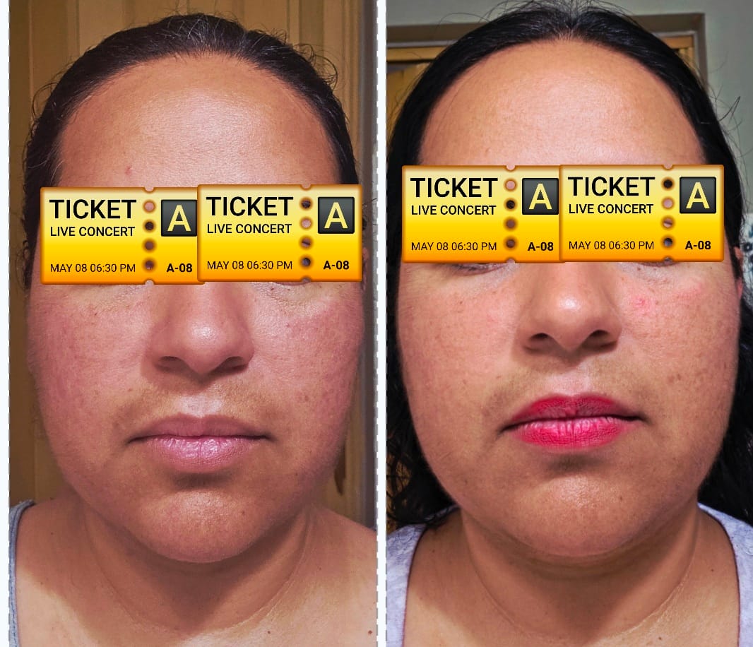 Customer photo review of Dark Spot + Hydration Starter Set
