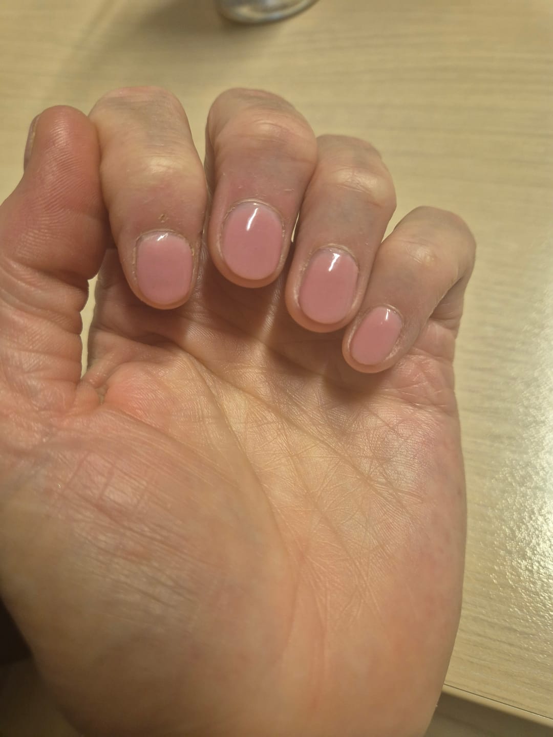 Customer photo review of Verzending Verzekering