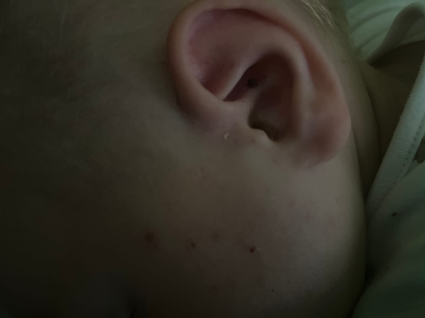 Customer photo review of Bioskin Junior Duo Pack