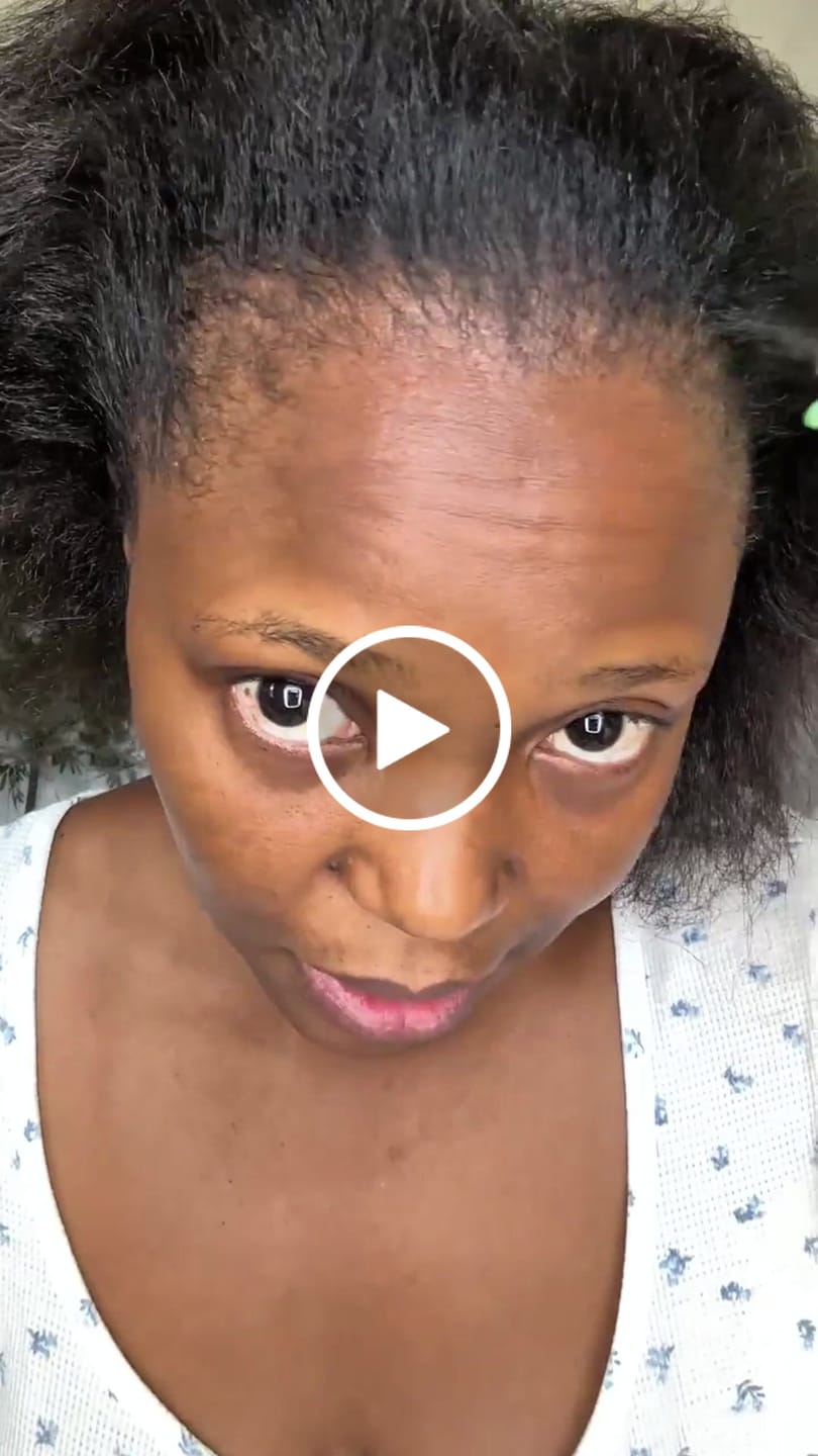Customer video review of Herbal Follicle Stimulator Oil - Scalp & Hair Strengthening