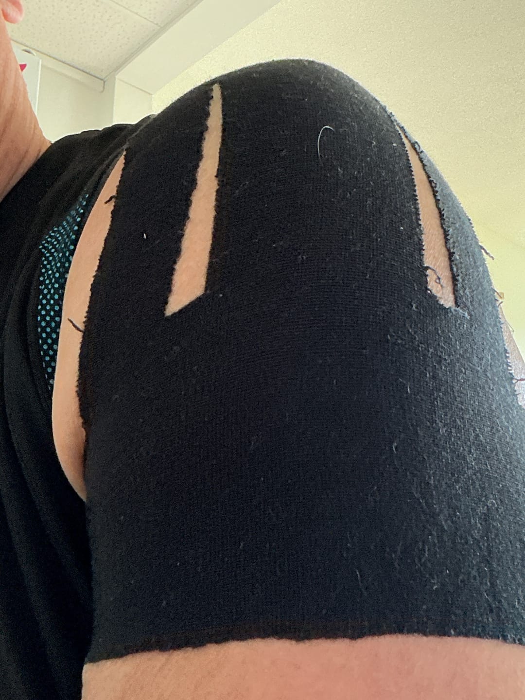Customer photo review of 💥HOT SALE 50% OFF🔥Pre-Cut Elastic Shoulder Support Kinesiology Tapes