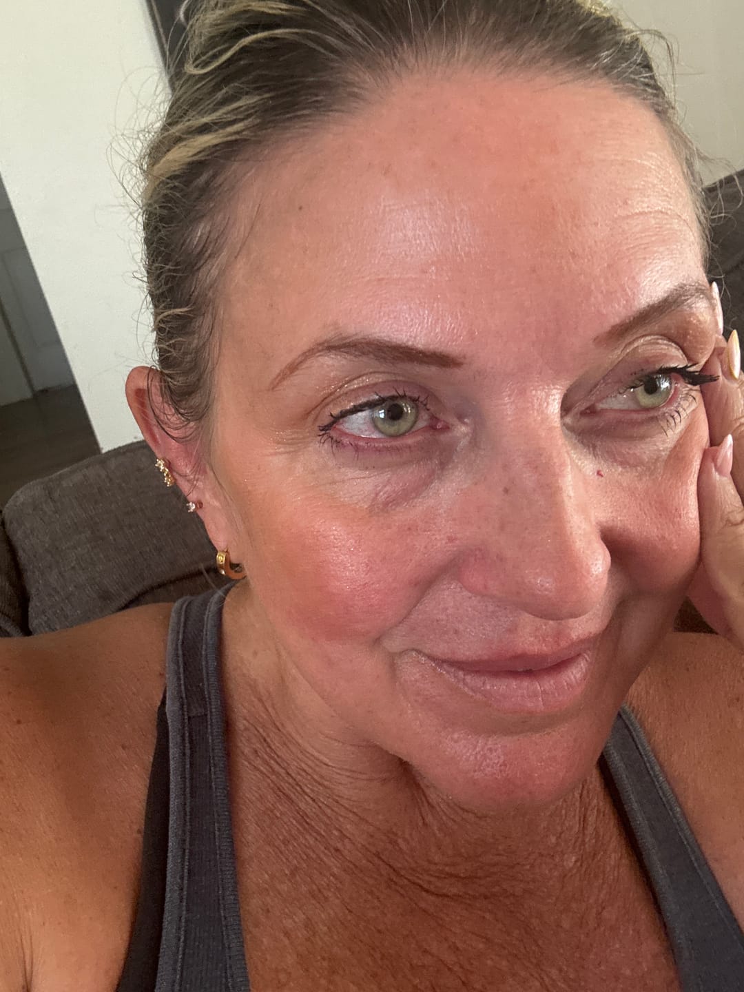 Customer photo review of Dose of Dreams Vitamin C Eye Cream