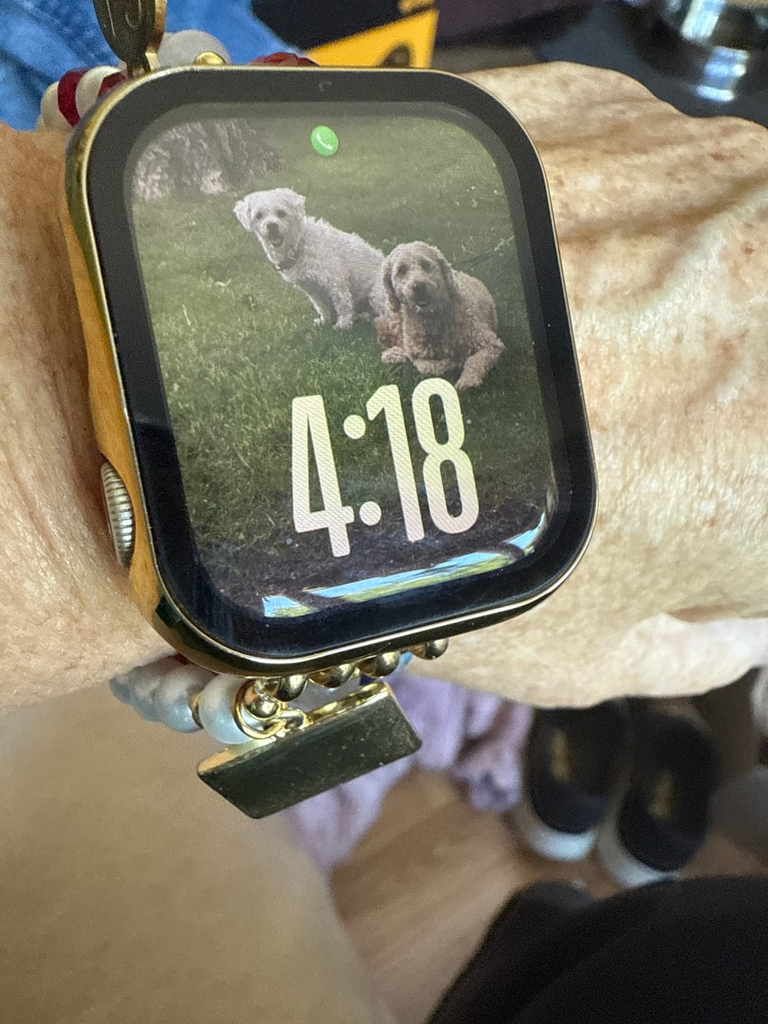 Customer photo review of American Dream Stretch Apple Watch Strap