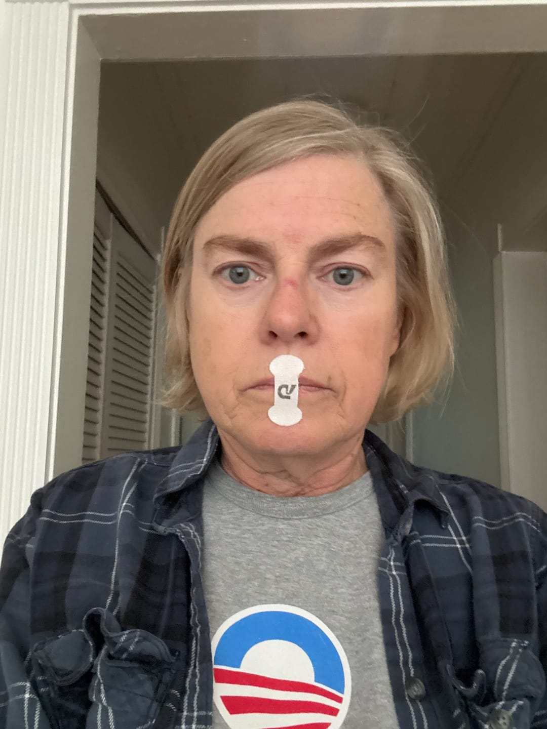 Customer photo review of Dream Mouth Tape Strips