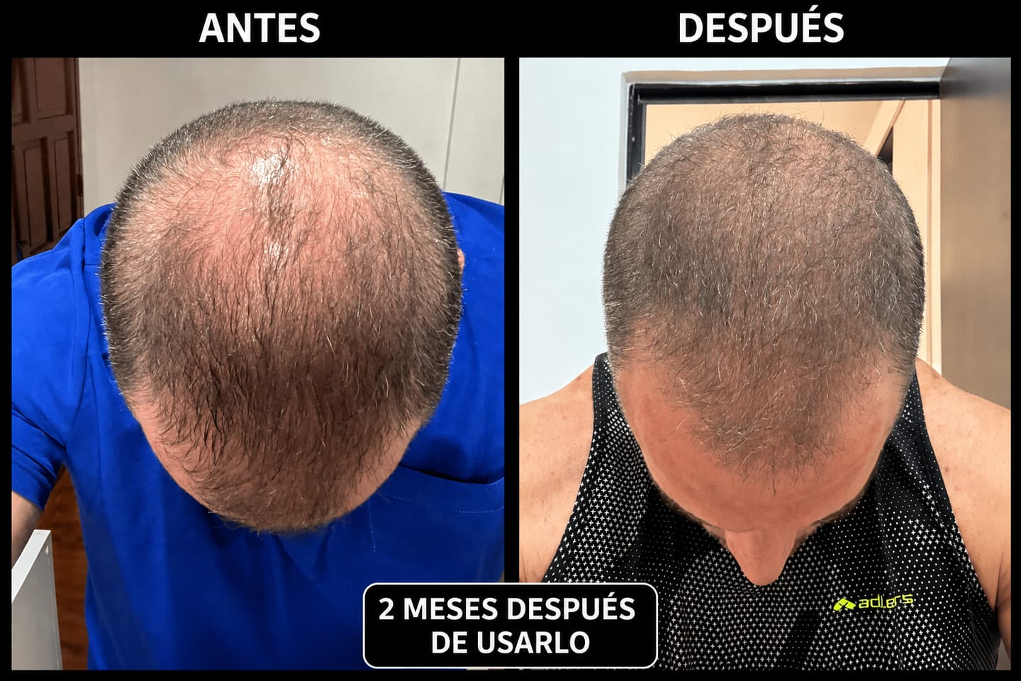 Customer photo review of Hair Tonic | Crecimiento Capilar 2X1