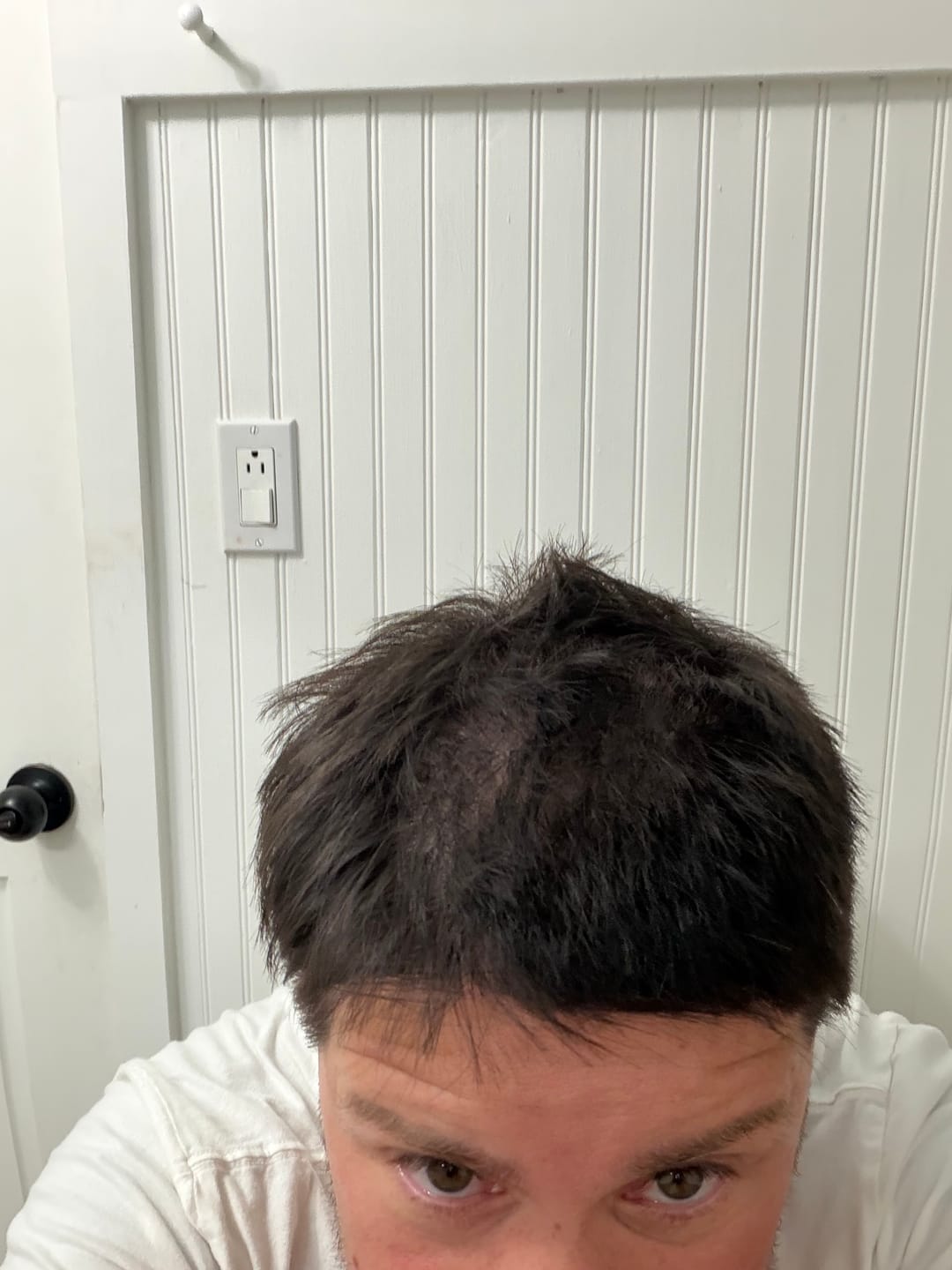 Customer photo review of Spartan™ Root Activator Shampoo 3 Bottles(sc)