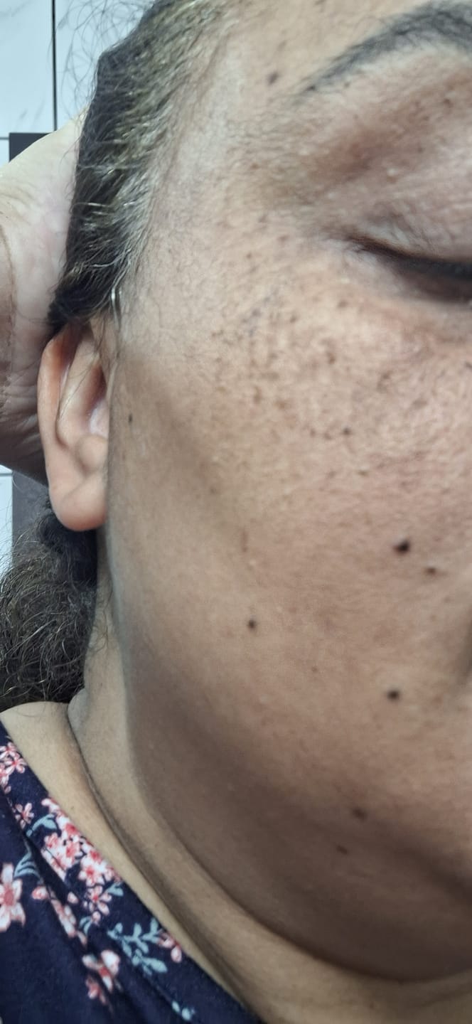 Customer photo review of Kit Clareamento Total + 1 Firmador de Brinde