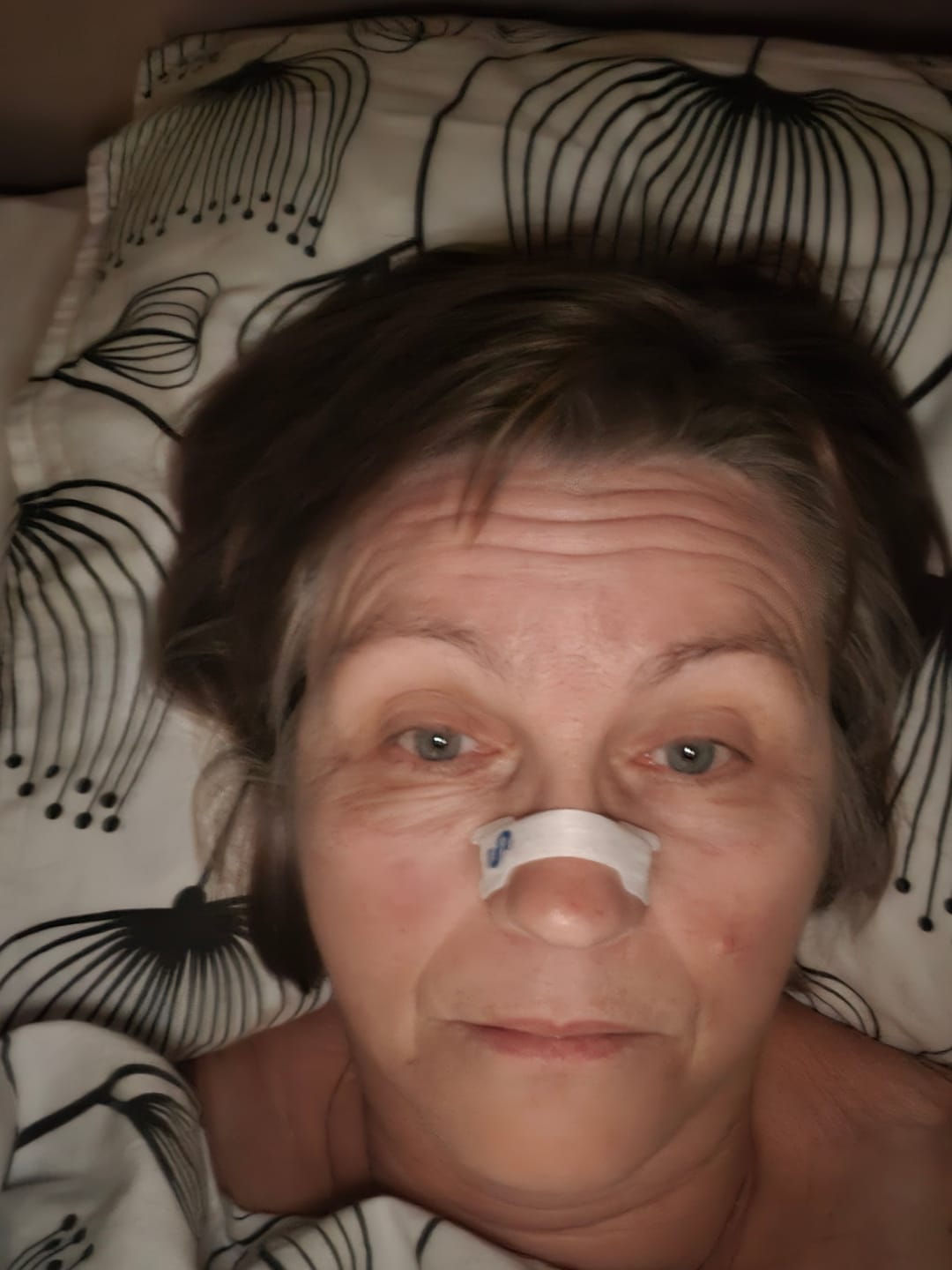 Customer photo review of Nuku Sleep Nasal Strips