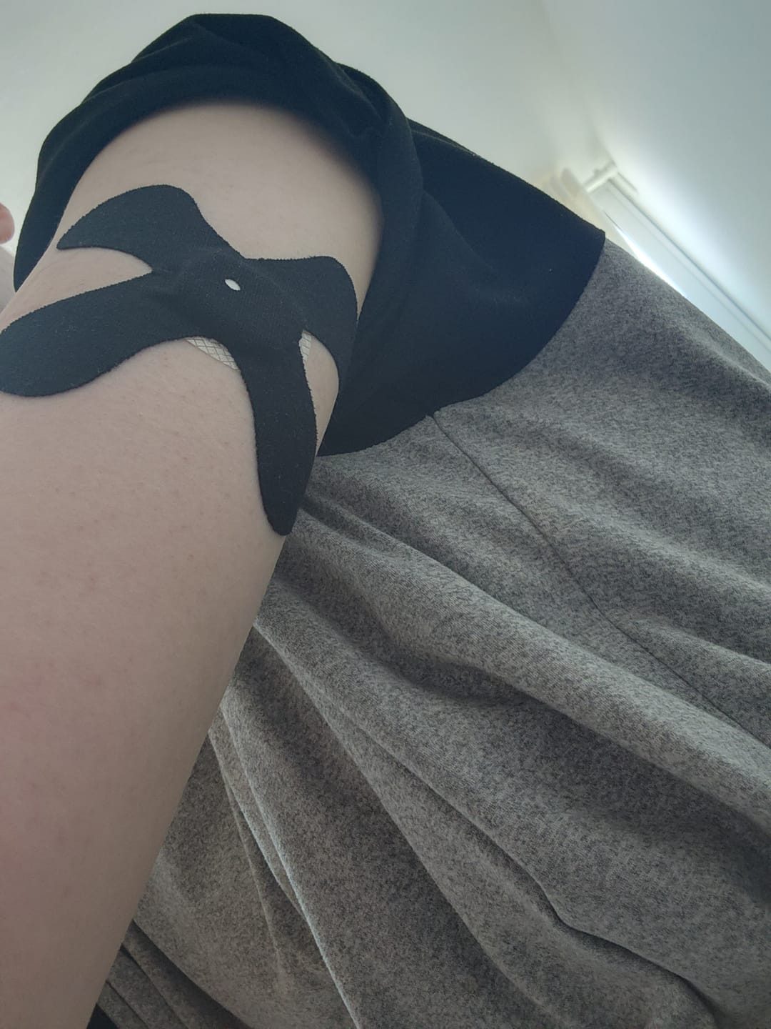 Customer photo review of Original Patch גוף 20 יח׳