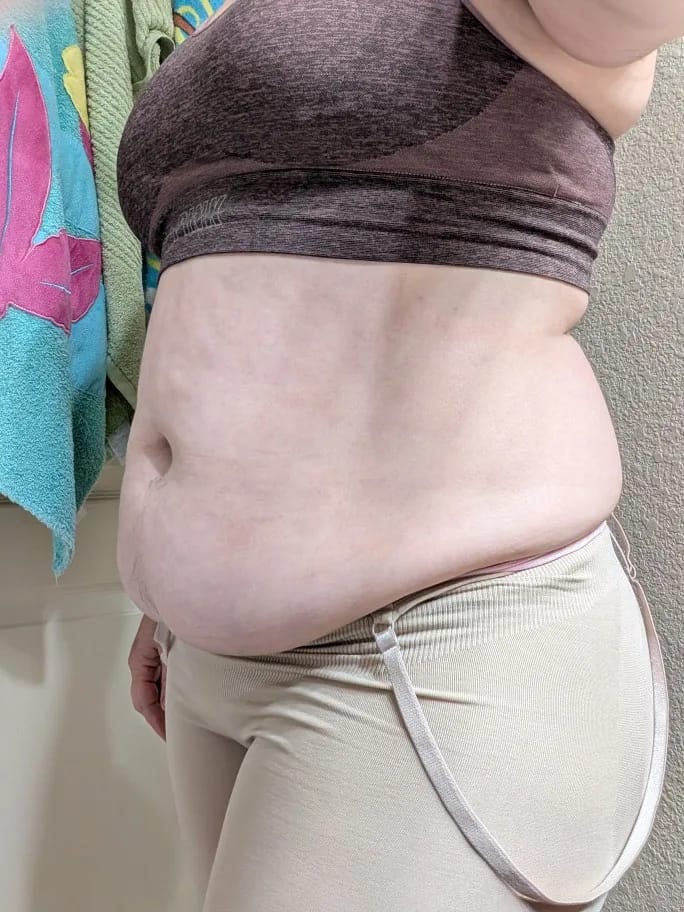 Customer photo review of Bodysuit SculptPlus Allure™