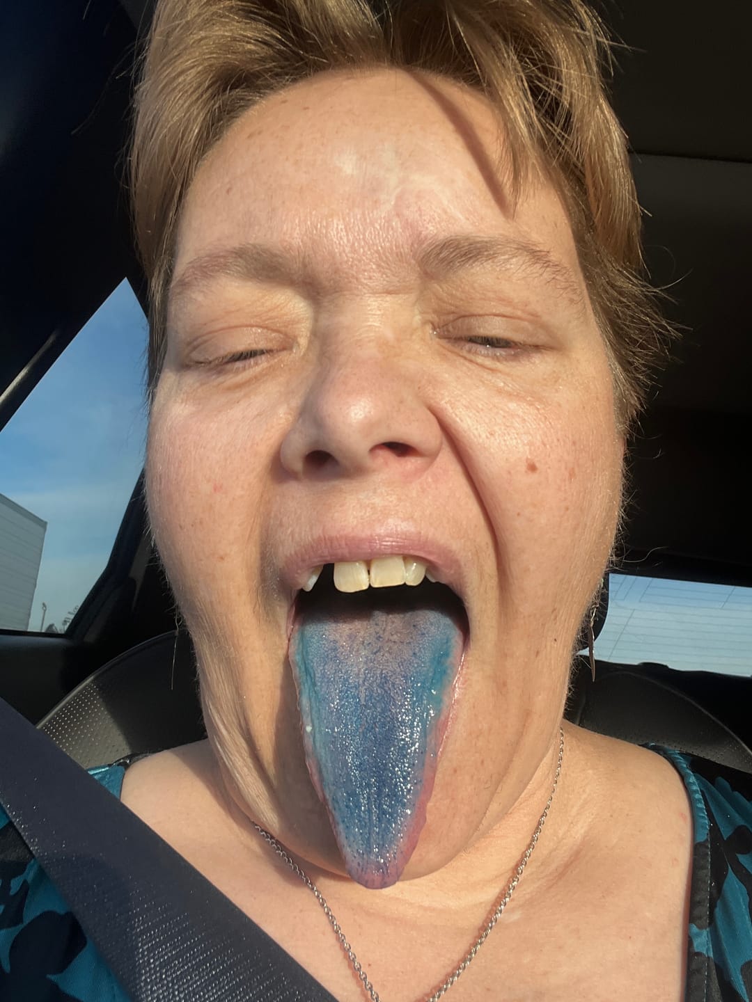 Customer photo review of Methylene Blue Tincture