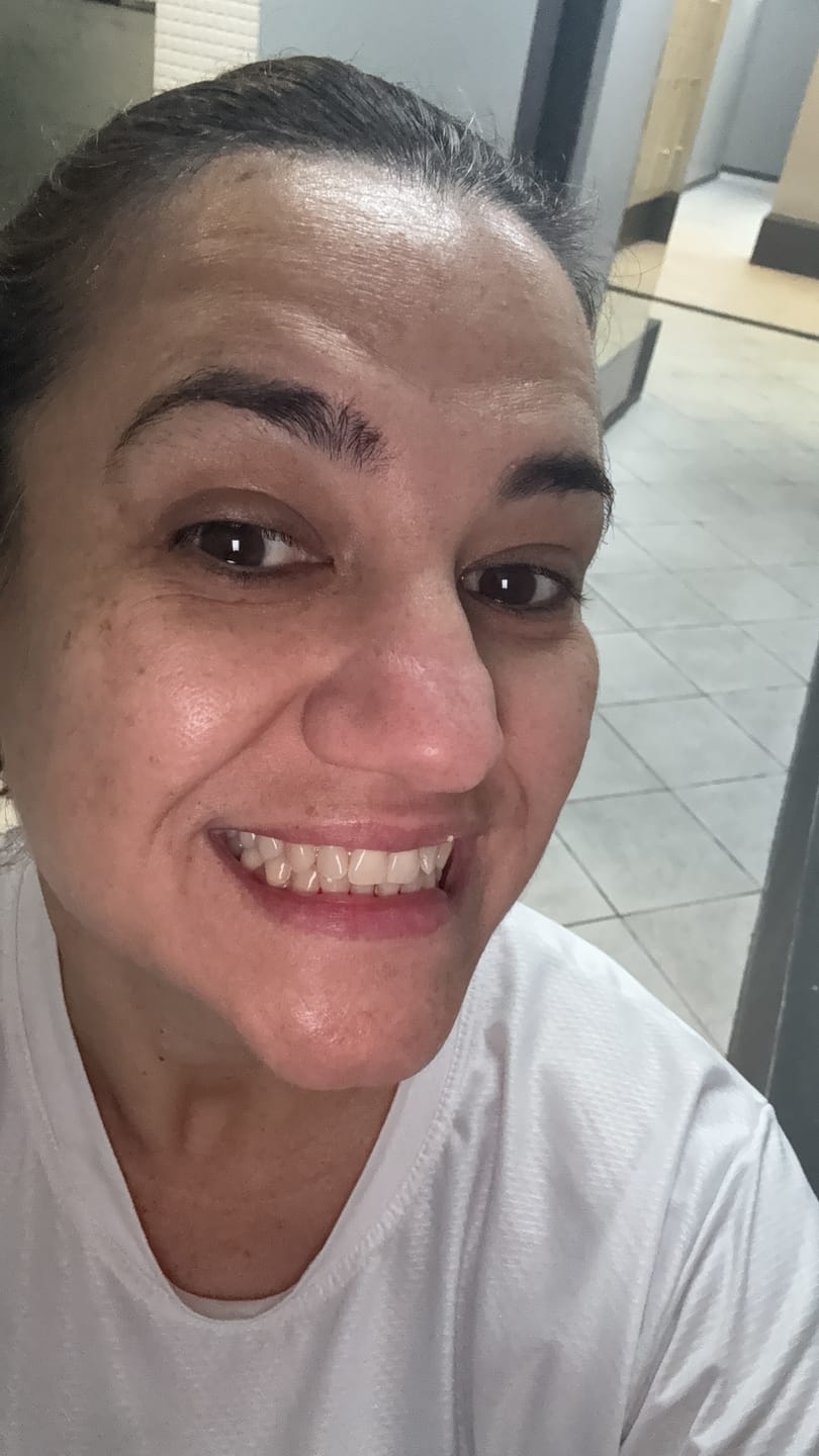 Customer photo review of Solução Vitamina C