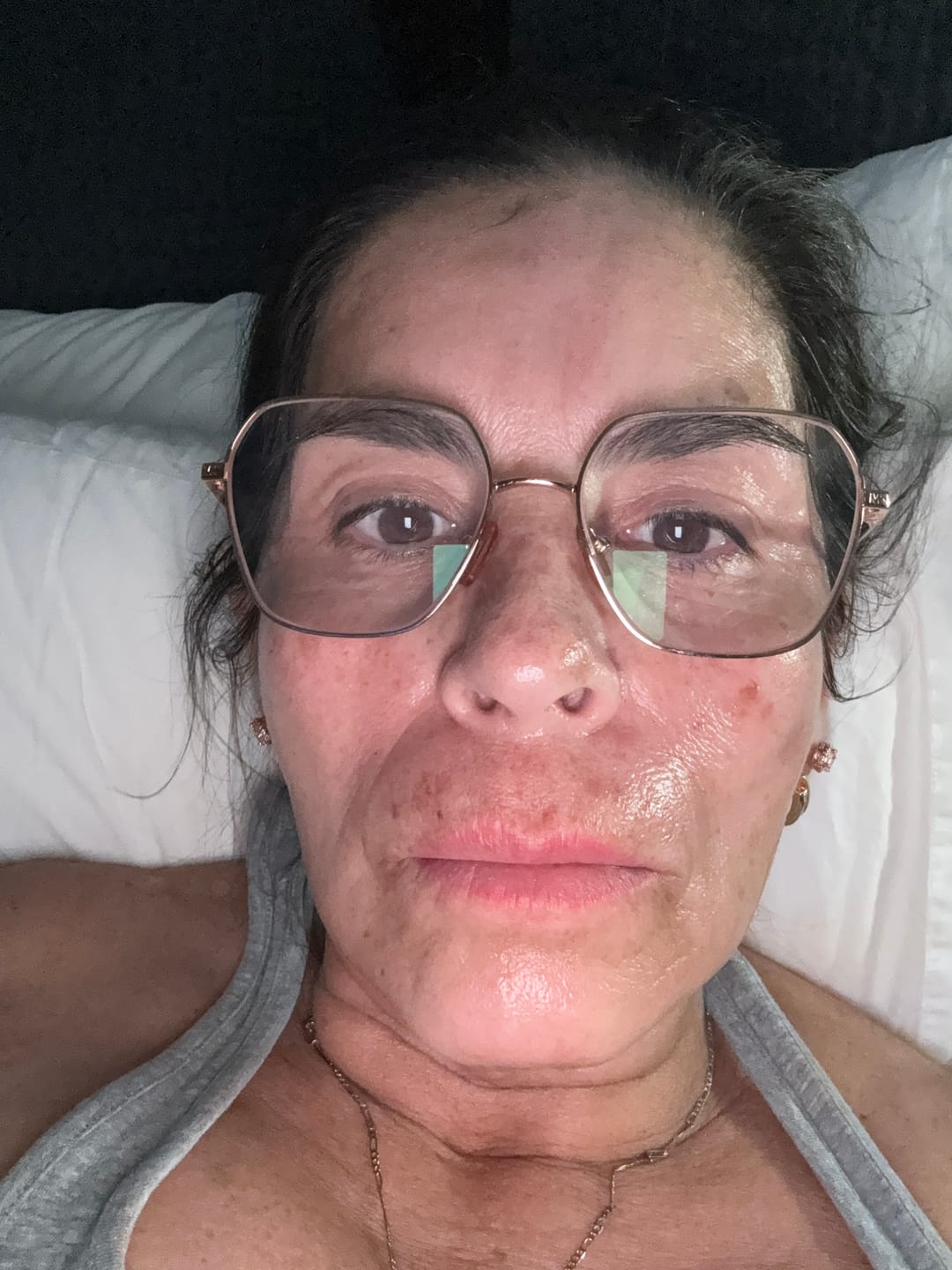 Customer photo review of 1 Month Supply - Micro Infusion Patches
