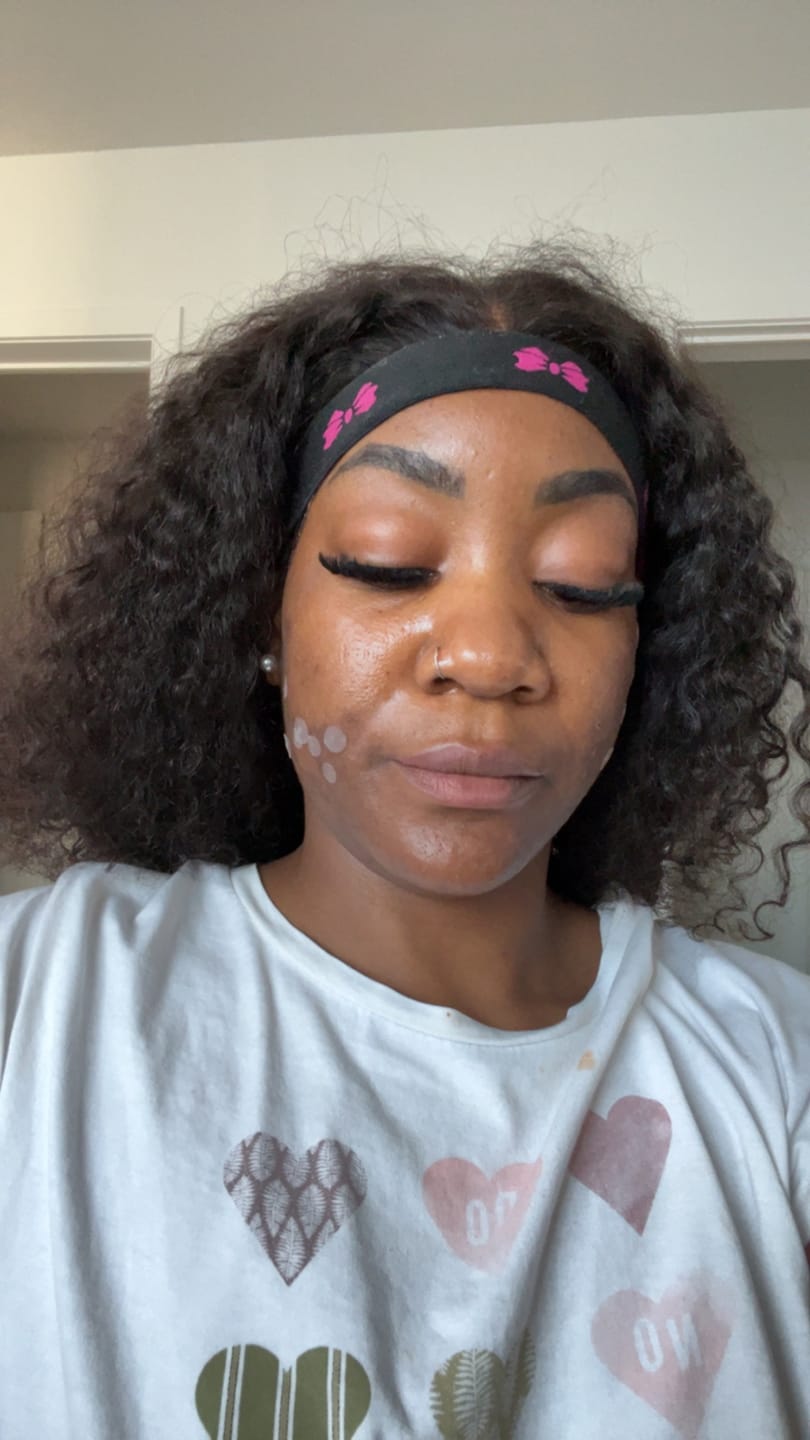 Customer photo review of Advanced brightening set