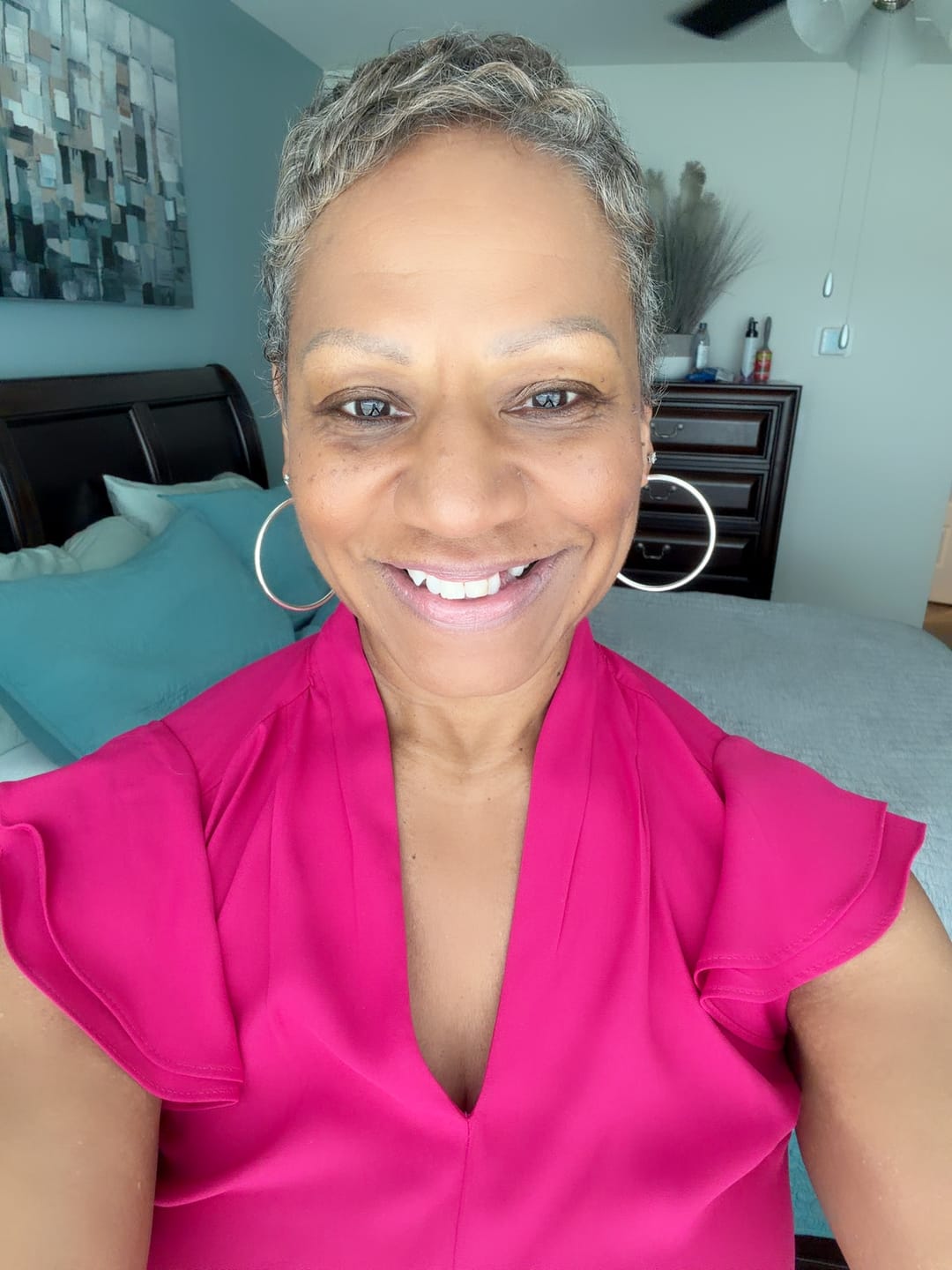 Customer photo review of Unilateral Partial Denture