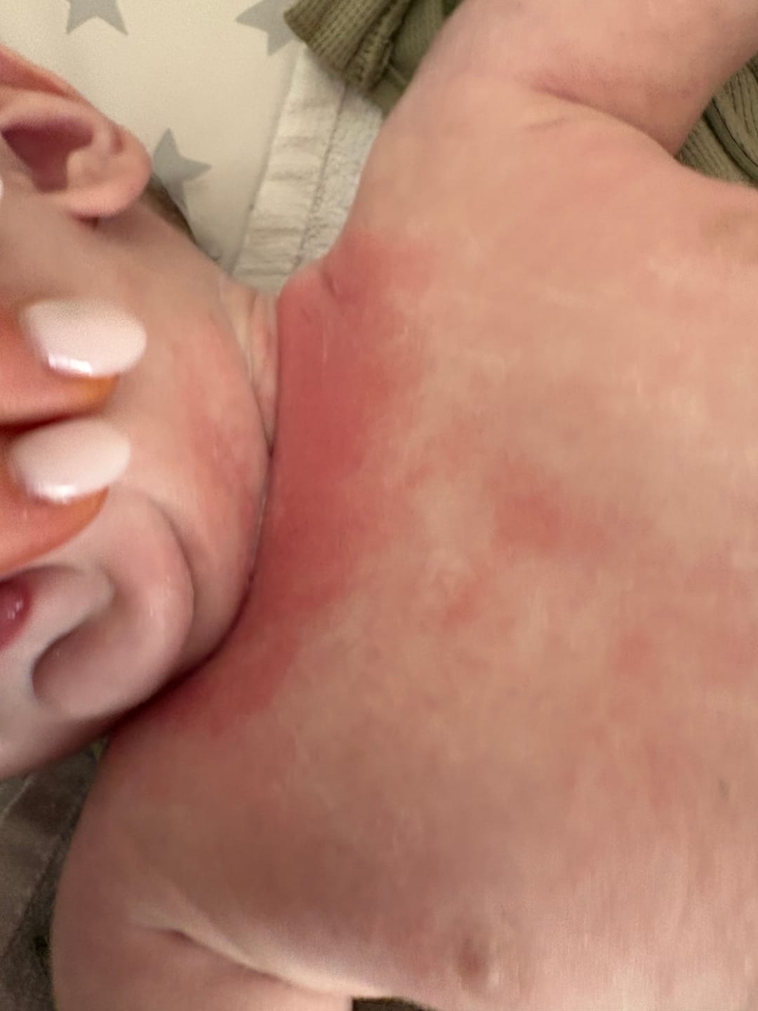 Customer photo review of Large Bioskin Junior Duo Pack