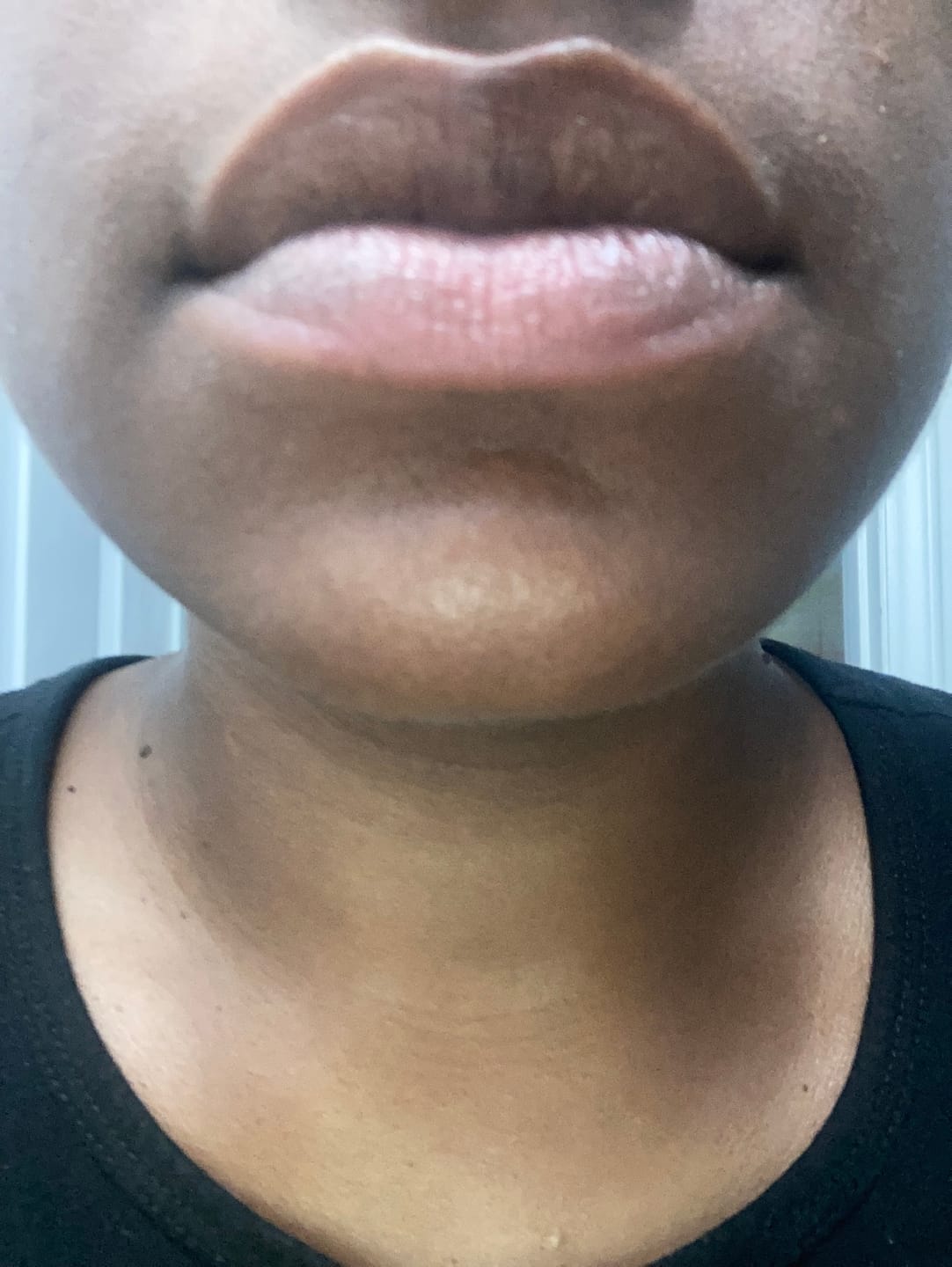 Customer photo review of Brightening Lip Bundle