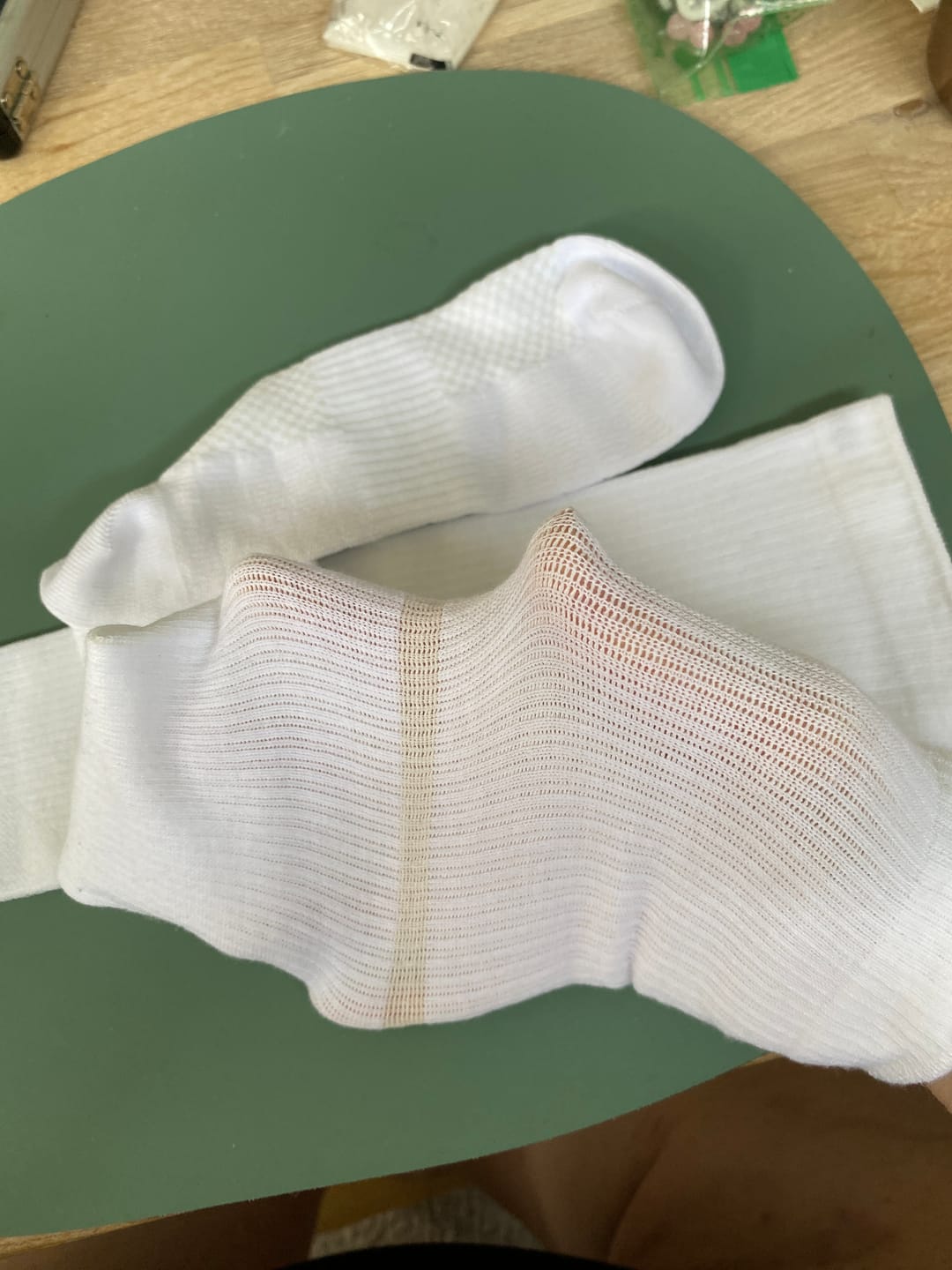 Customer photo review of Tynde støttestrømper