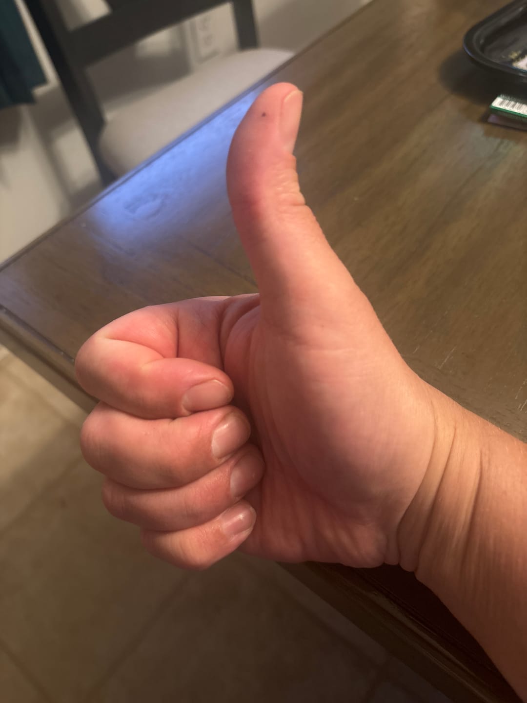 Customer photo review of Candy Cartel Light Assist THCA