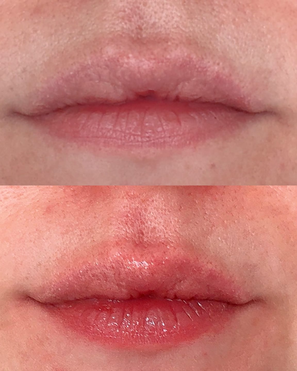 Customer photo review of Petitfee Super Volum leppeolje