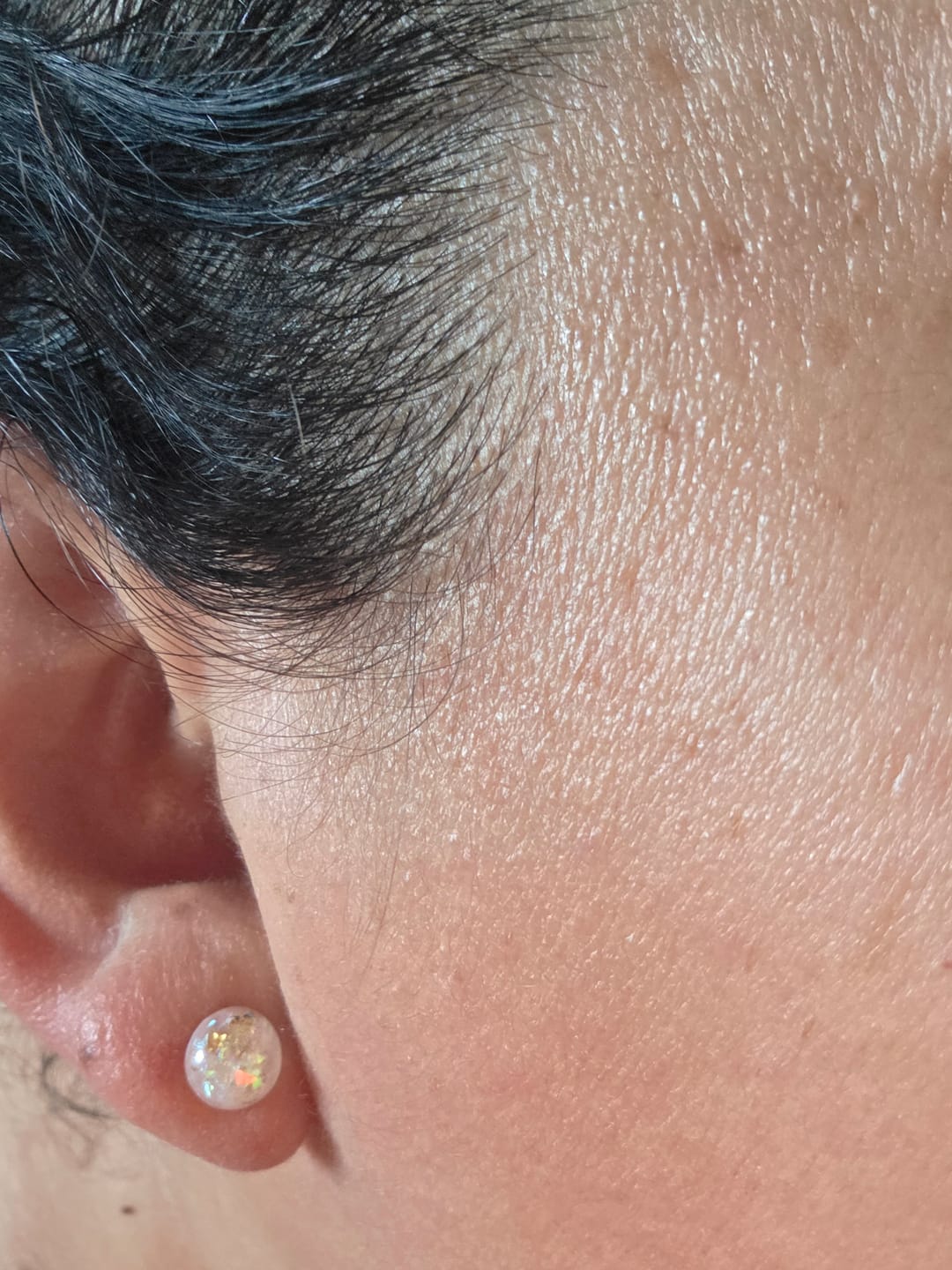 Customer photo review of Gold Fleck Button 8mm Studs Hypoallergenic Earrings for Sensitive Ears with Plastic Posts