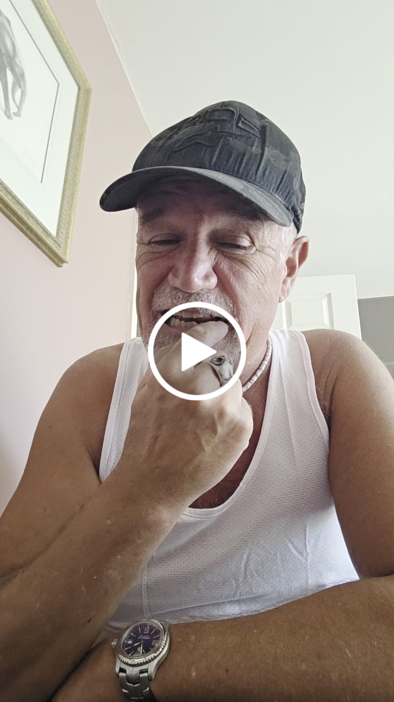 Customer video review of Click-in Veneers 4.0