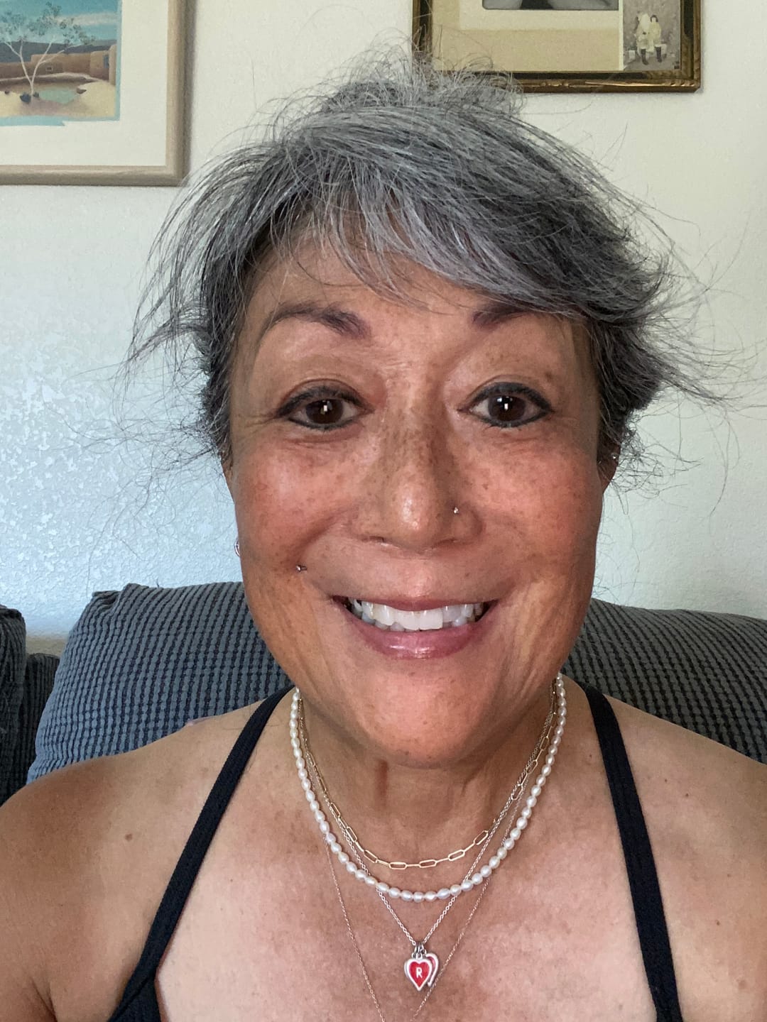 Customer photo review of Tallow Balm Advanced w/ Ceramides & Hyaluronic Acid
