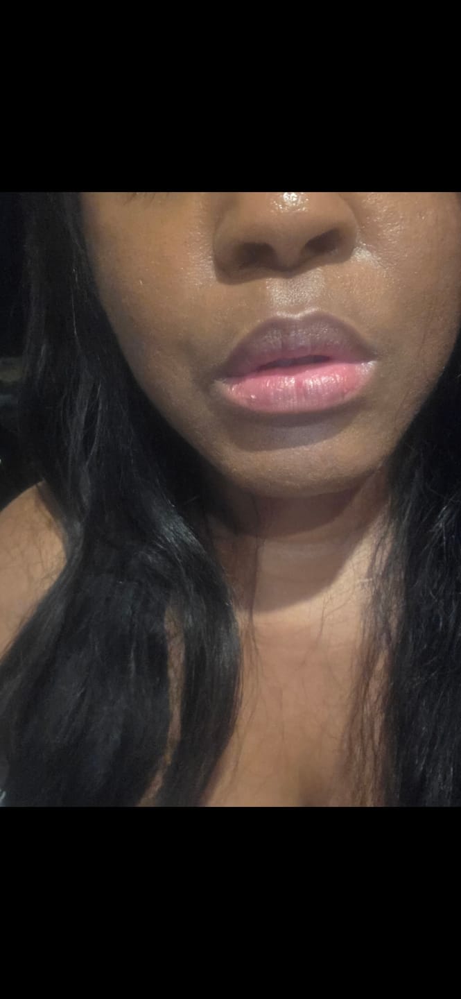 Customer photo review of Areliaa Lip Plumper