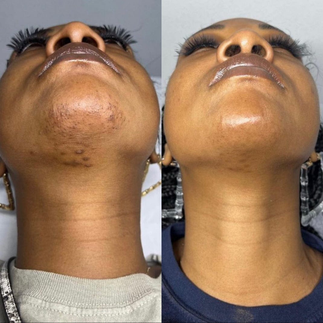 Customer photo review of Rasoio 2 in 1 per Bikini e Corpo Shape Up™