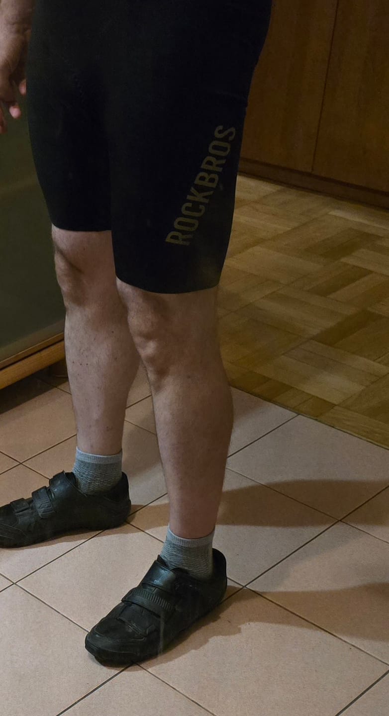 Customer photo review of Profesjonalne Spodenki Rowerowe One-Piece Z Elastic Interface® Wkładką-YDDK013-1