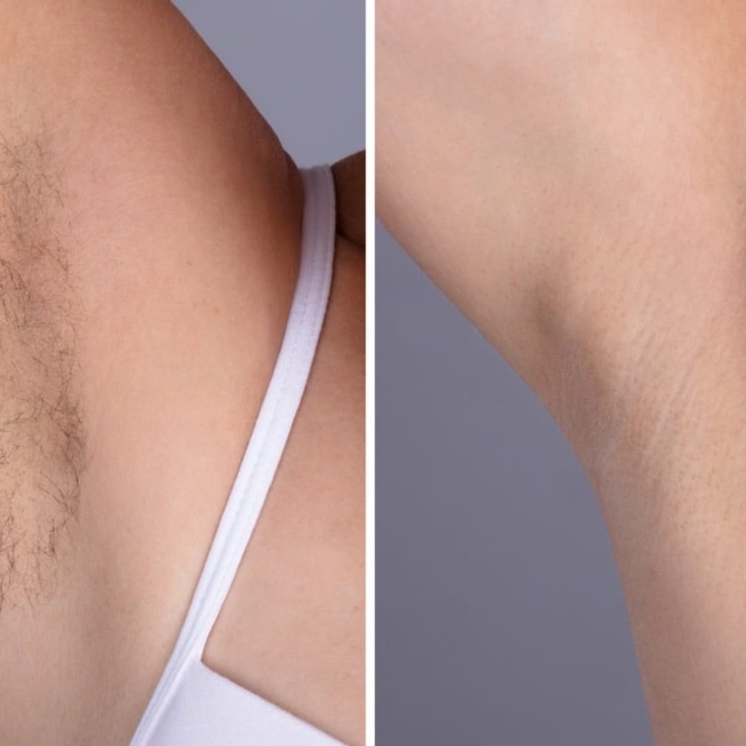 Customer photo review of Rasoio 2 in 1 per Bikini e Corpo Shape Up™