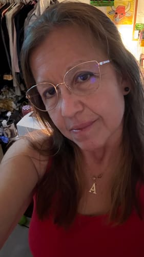 Reviewer's selfie showing her facial skin after using the Seranova Micro Infusion System for a month and a half.