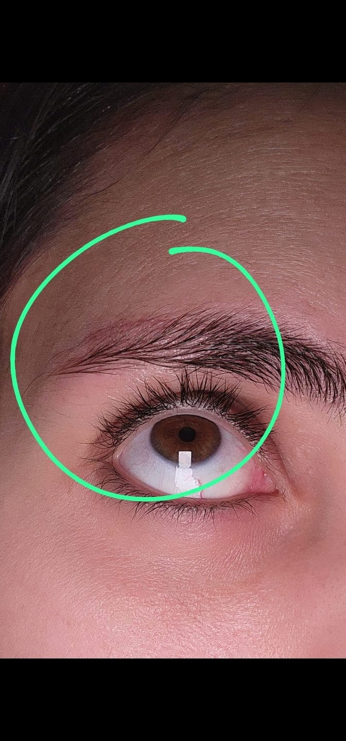 Customer photo review of Eyebrow Growth Roller