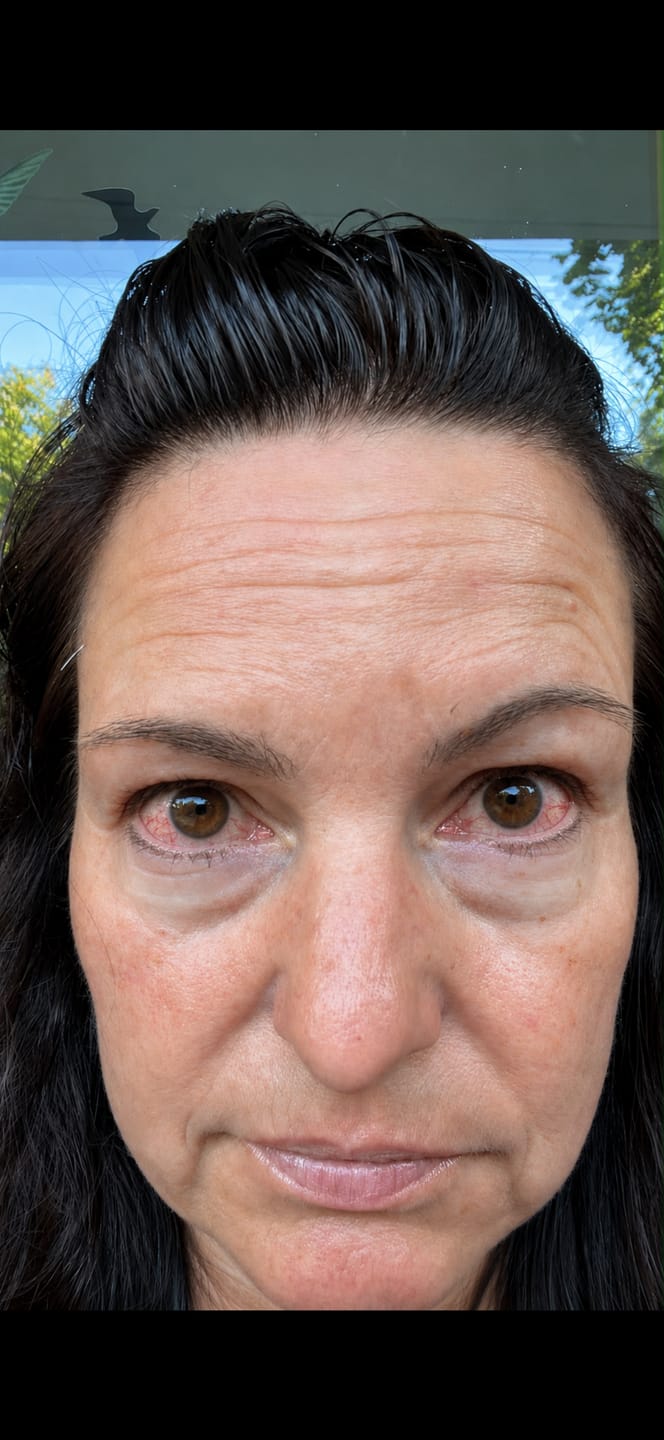 Customer photo review of LASHCOCA!NE - Wimpernserum