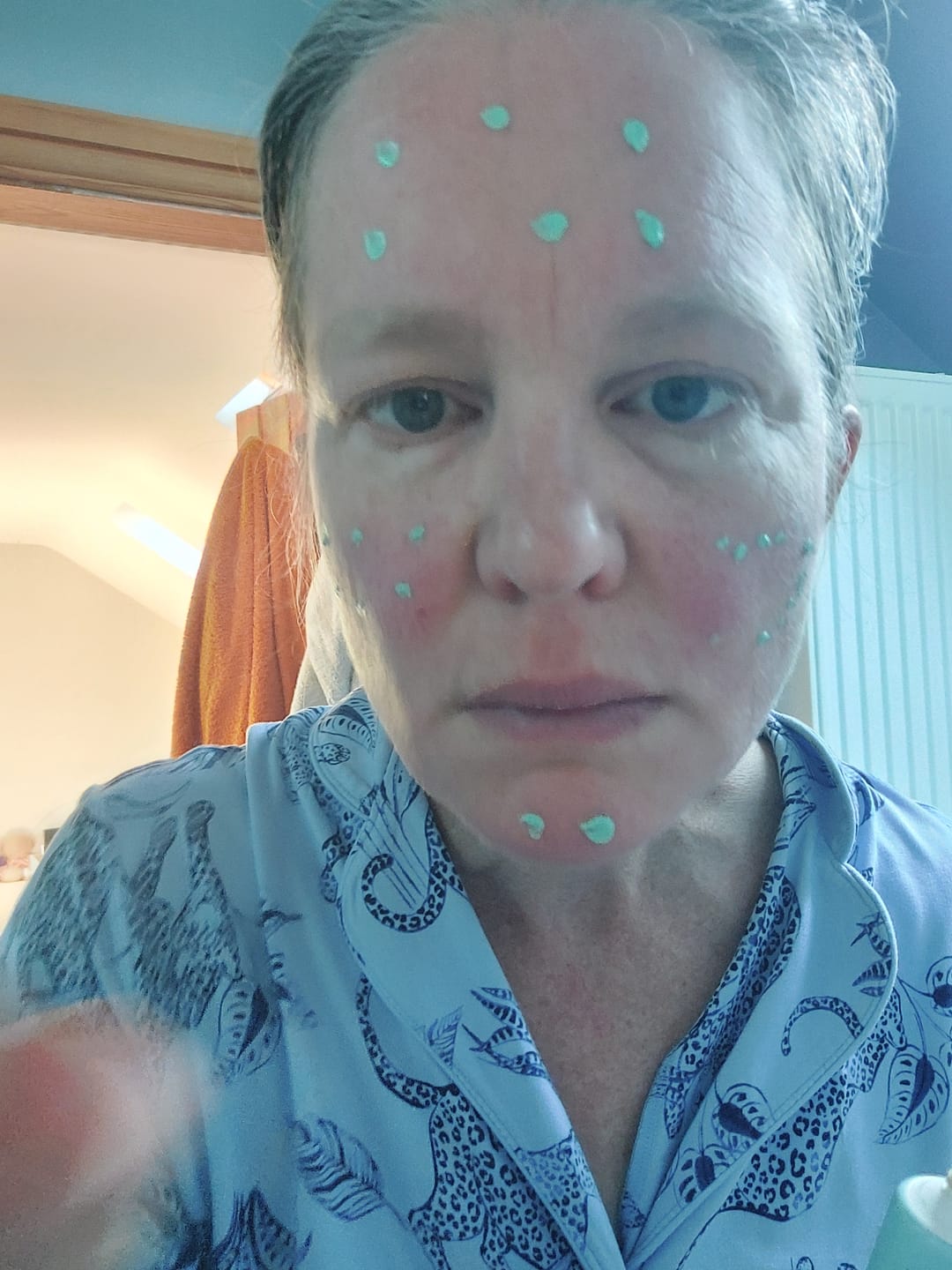Customer photo review of Rosalique 3 in 1 Anti-Redness Miracle Formula SPF50