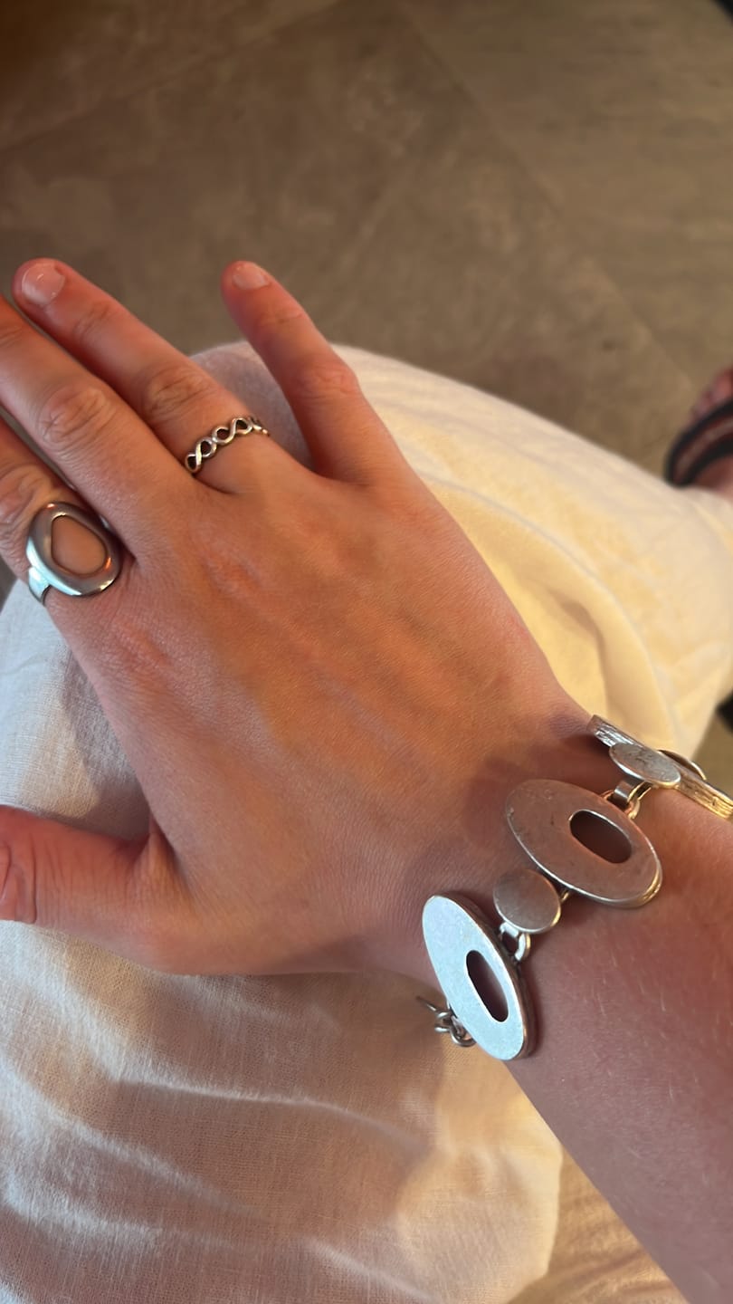 Customer photo review of Bottle Opener Ring