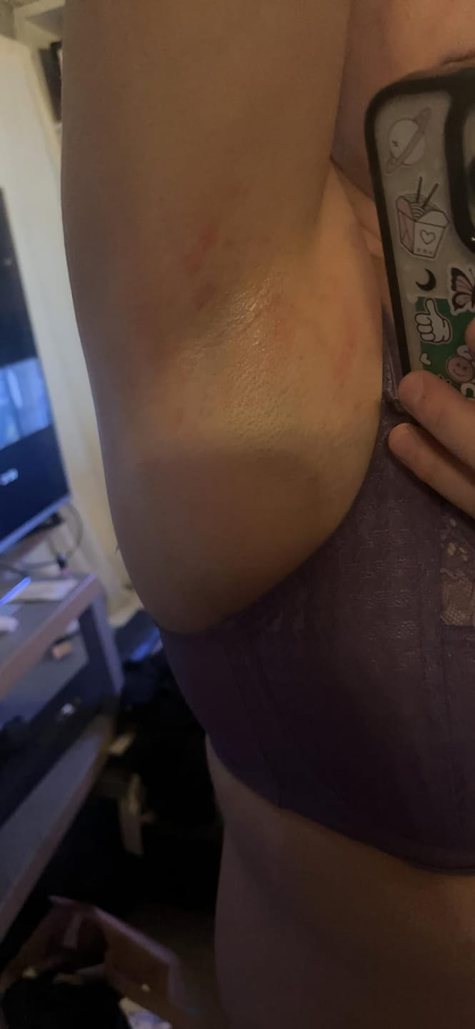 Customer photo review of SilkyLisse | Le Rasoir Féminin 2-en-1 Pour Zones Sensibles