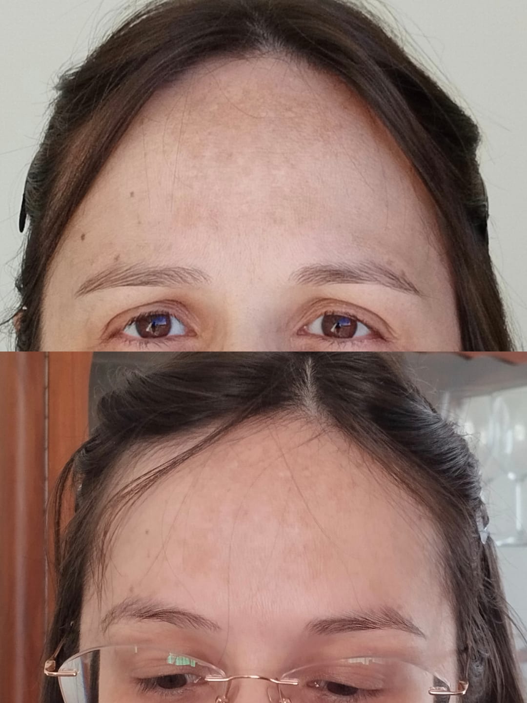 Customer photo review of Solução Oxyresveratrol
