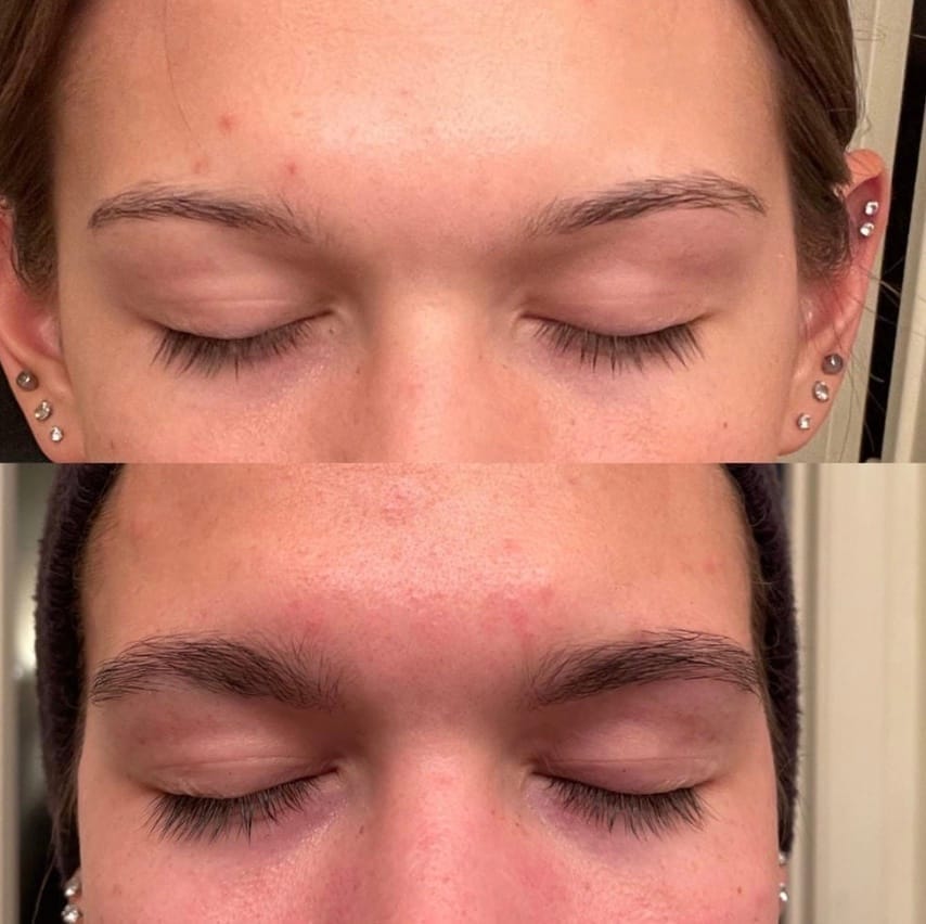 Customer photo review of Eyebrow Growth Roller