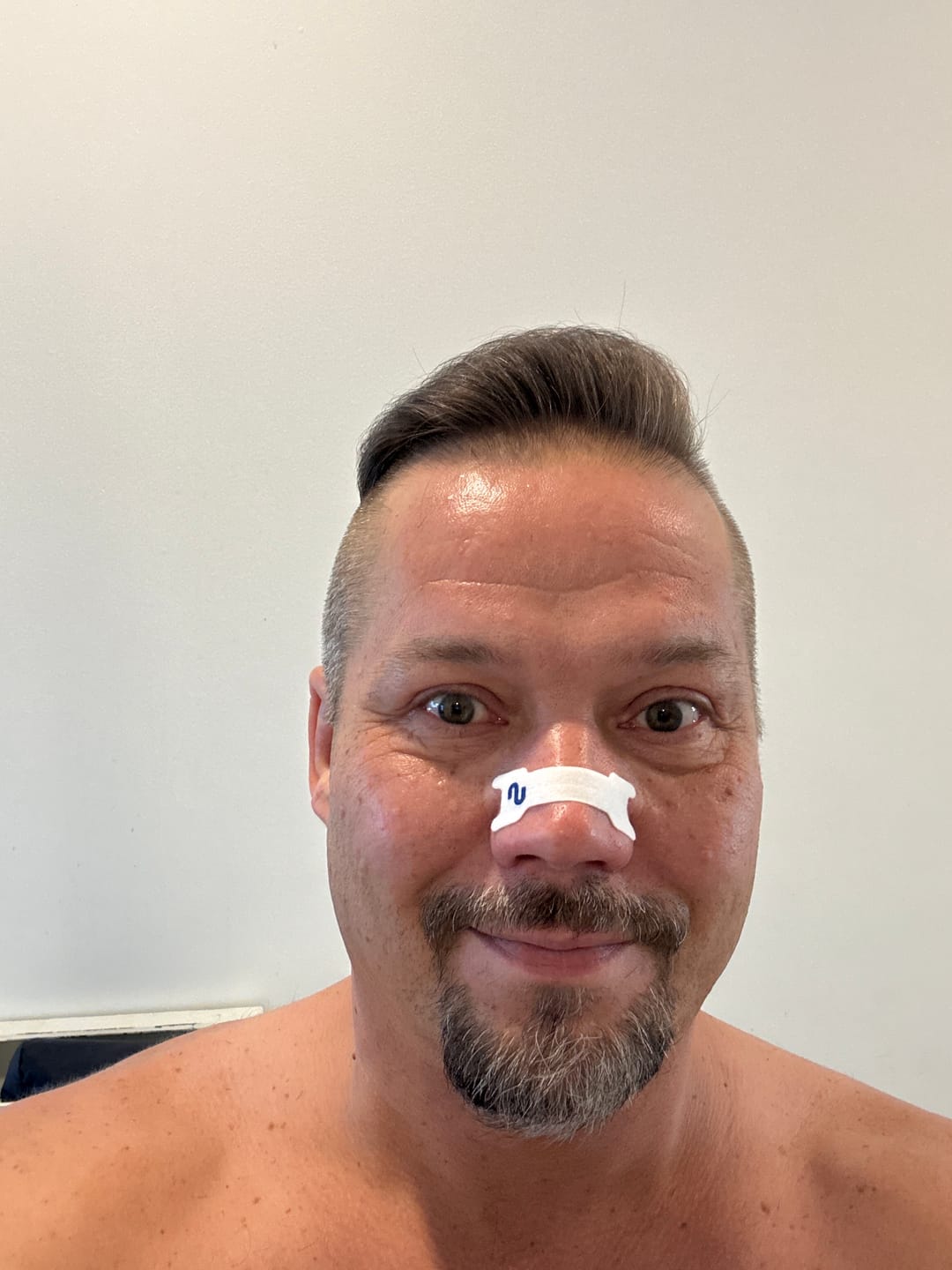 Customer photo review of Nuku Sleep Nasal Strips