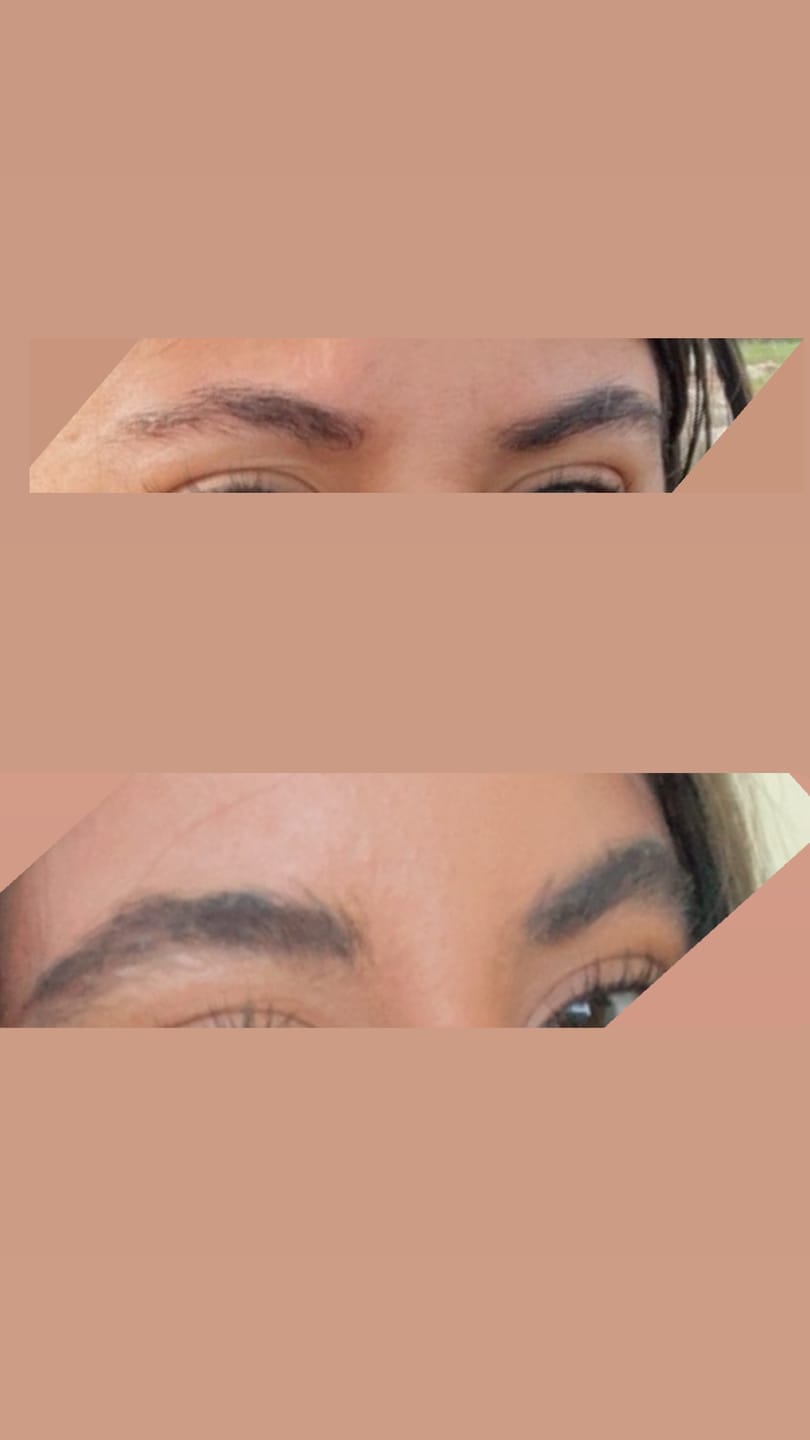 Customer photo review of Eyebrow Growth Roller