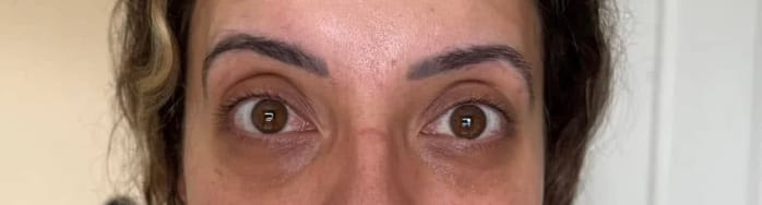 Customer photo review of Mivo Lumière™ משקפי 2-ב-1: אור אדום + EMS להפחתת שקיות ונפיחות מתחת לעיניים