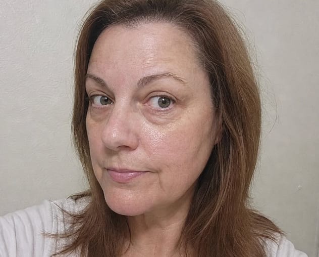 Customer photo review of Mivo Lumière™ משקפי 2-ב-1: אור אדום + EMS להפחתת שקיות ונפיחות מתחת לעיניים
